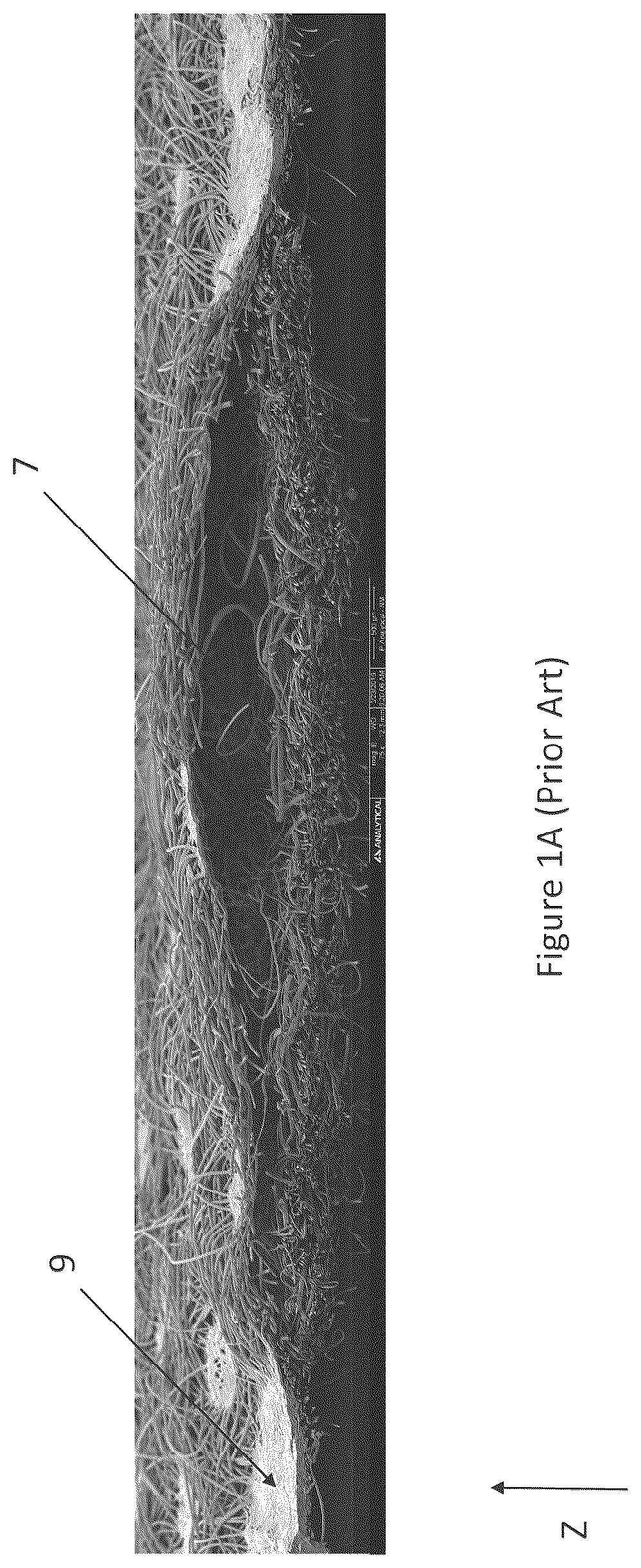 Patent US12310825 Figure 1 – Absorbent article with conforming features