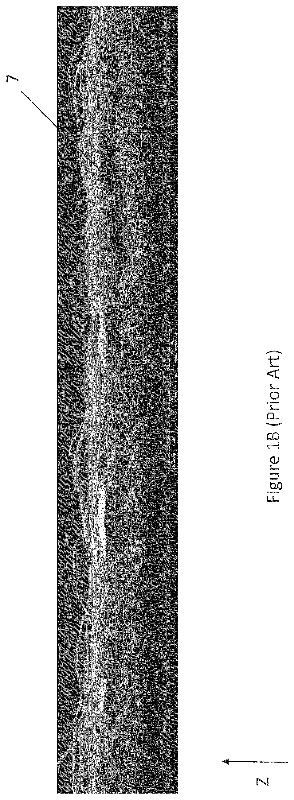 Patent US12310825 Figure 2 – Absorbent article with conforming features
