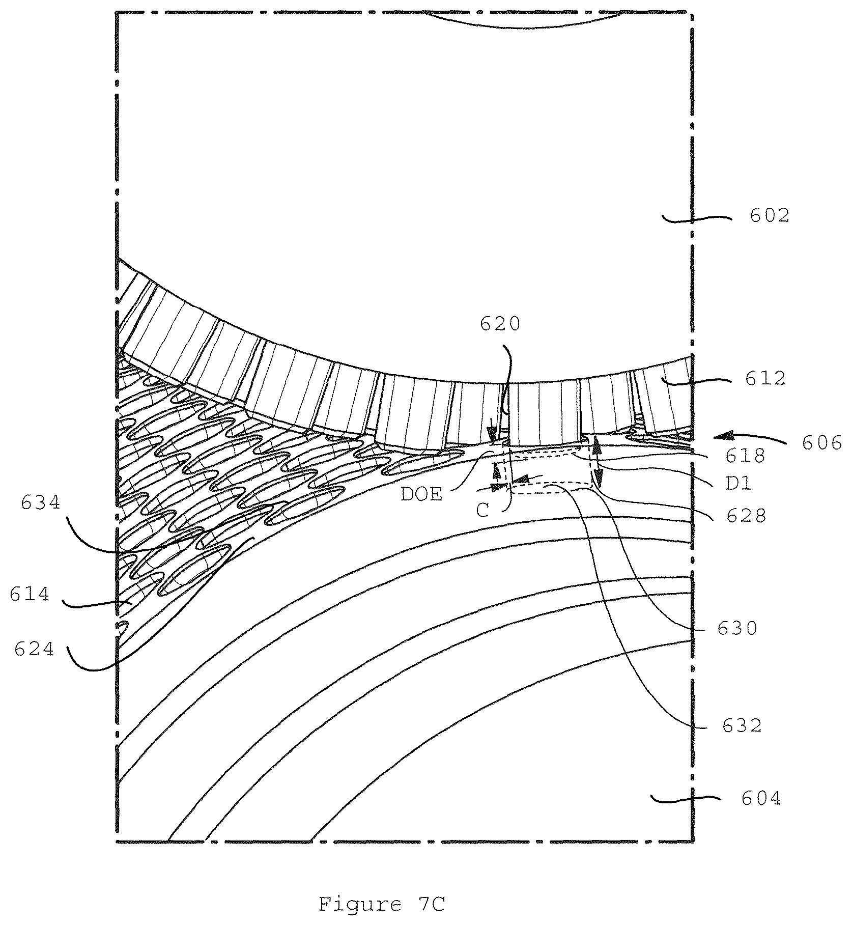 Patent US12310825 Figure 17 – Absorbent article with conforming features