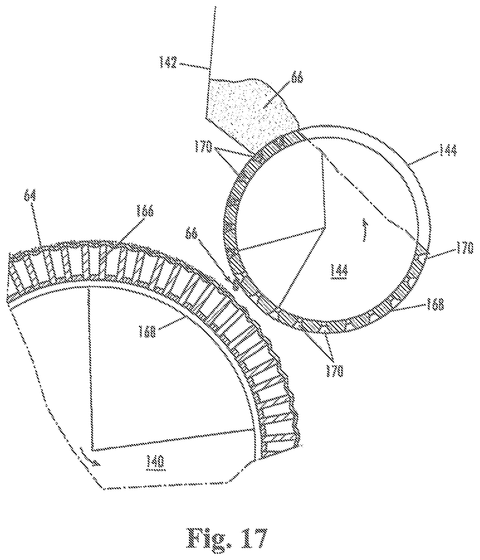 Patent US12310829 Figure 16 – Disposable absorbent article