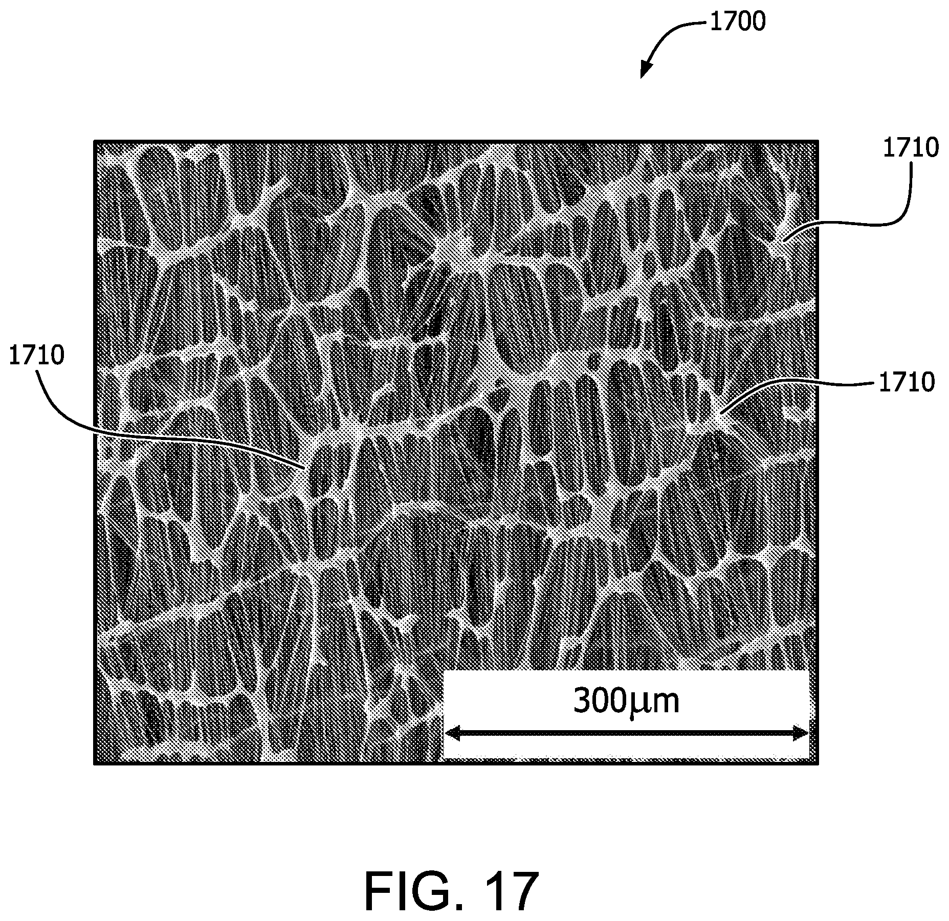 Patent US12310830 Figure 18 – Biocompatible membrane composite