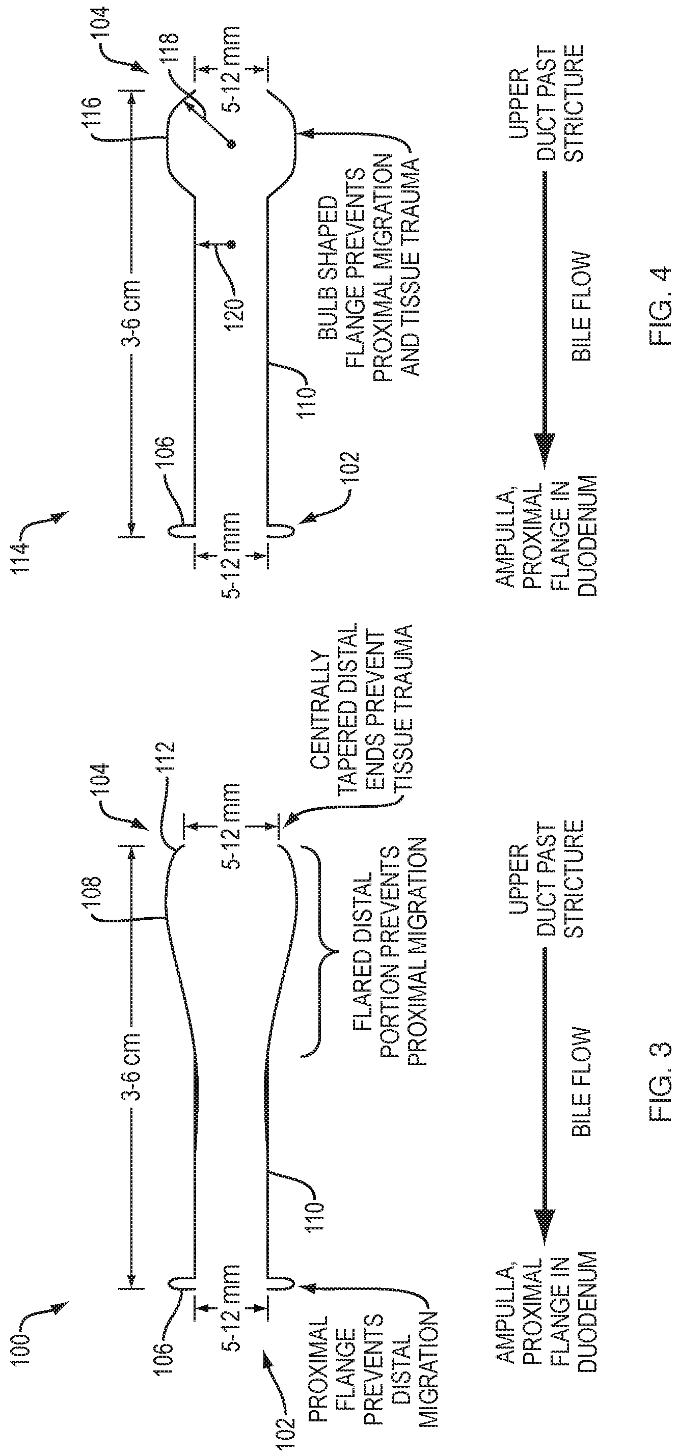 Patent US12310832 Figure 4 – Biliary stents and methods