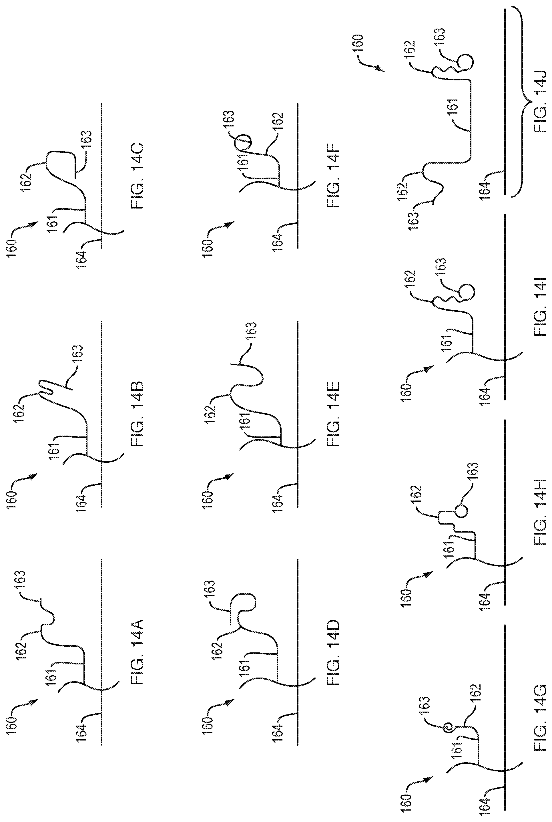 Patent US12310832 Figure 11 – Biliary stents and methods