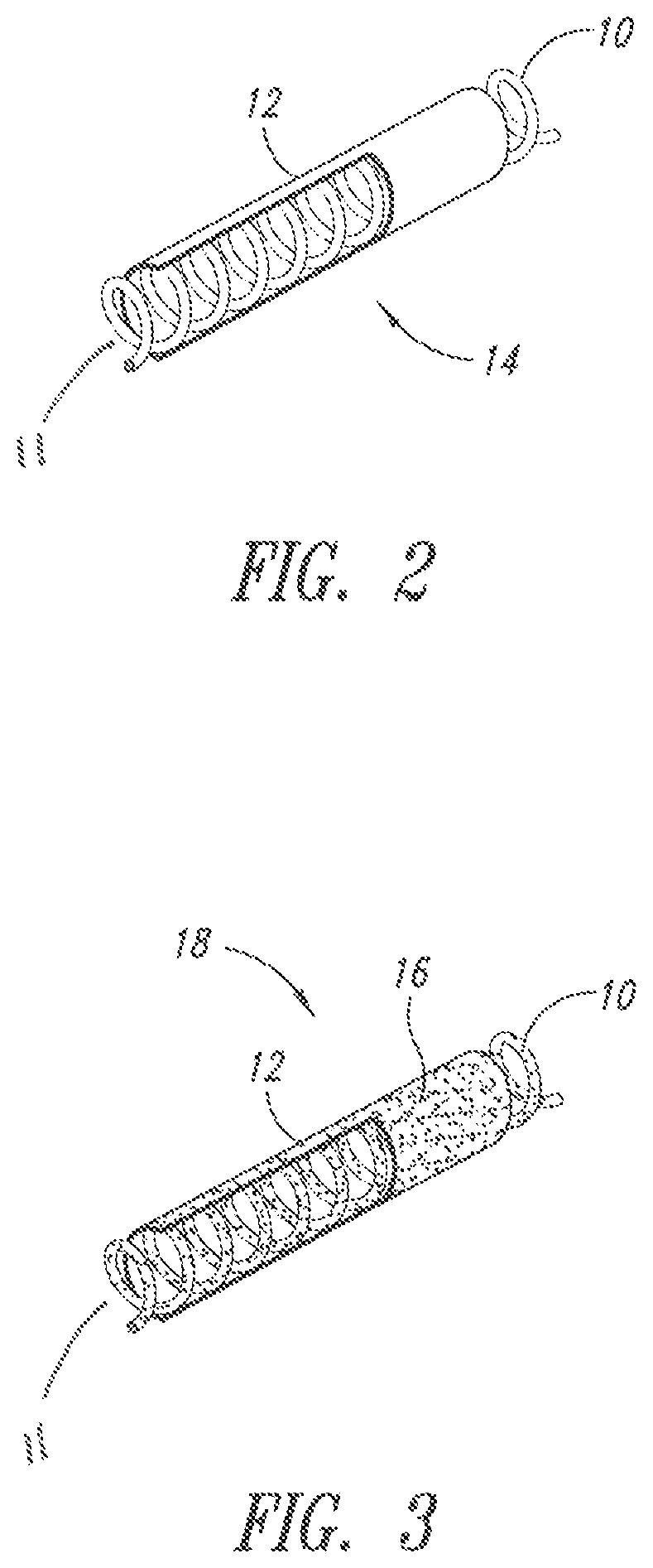 Patent US12310833 Figure 2 – Medical implants having managed biodegradation