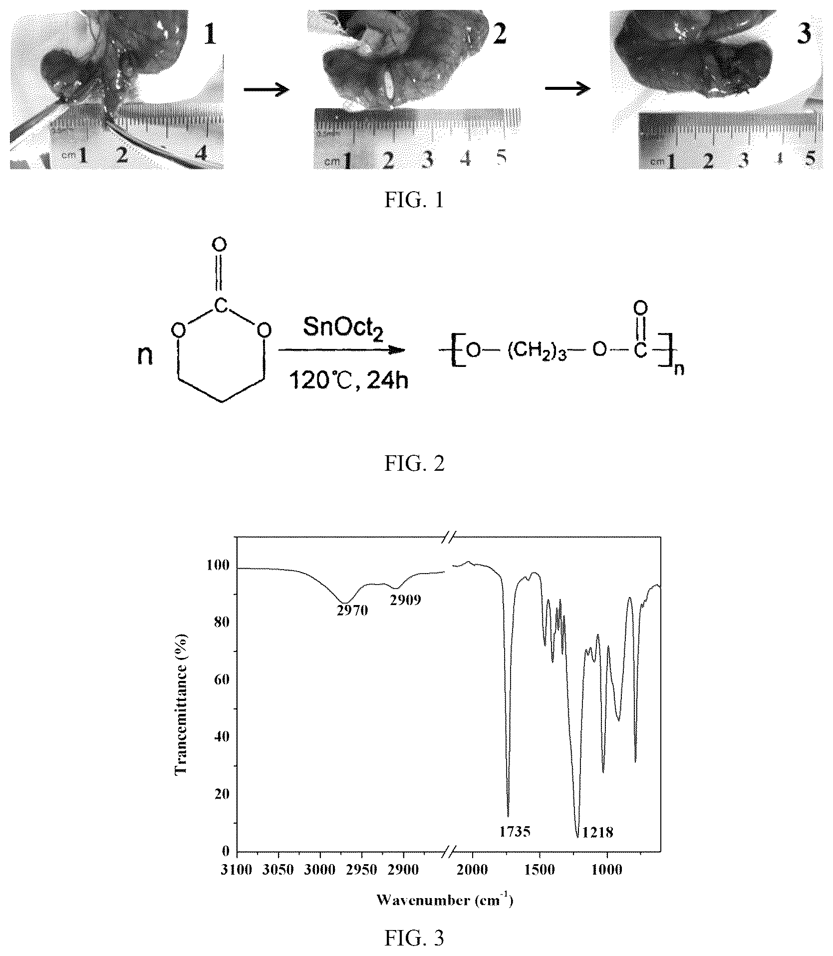Patent US12310834 Figure 1 – PTMC-based intestinal anastomosis stent of bioabsorbable flexible elastomer and preparation method therefor