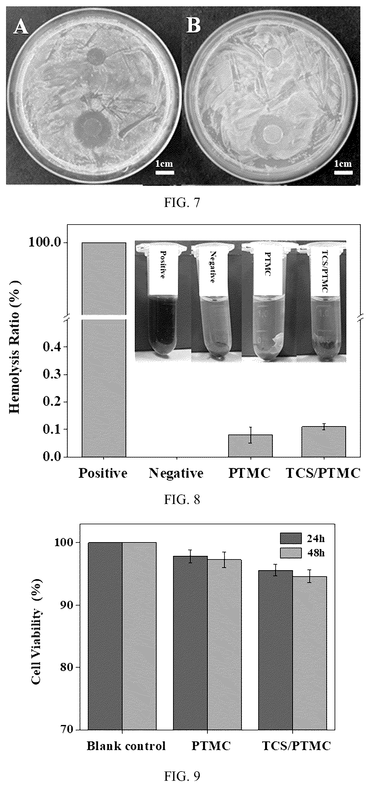 Patent US12310834 Figure 4 – PTMC-based intestinal anastomosis stent of bioabsorbable flexible elastomer and preparation method therefor