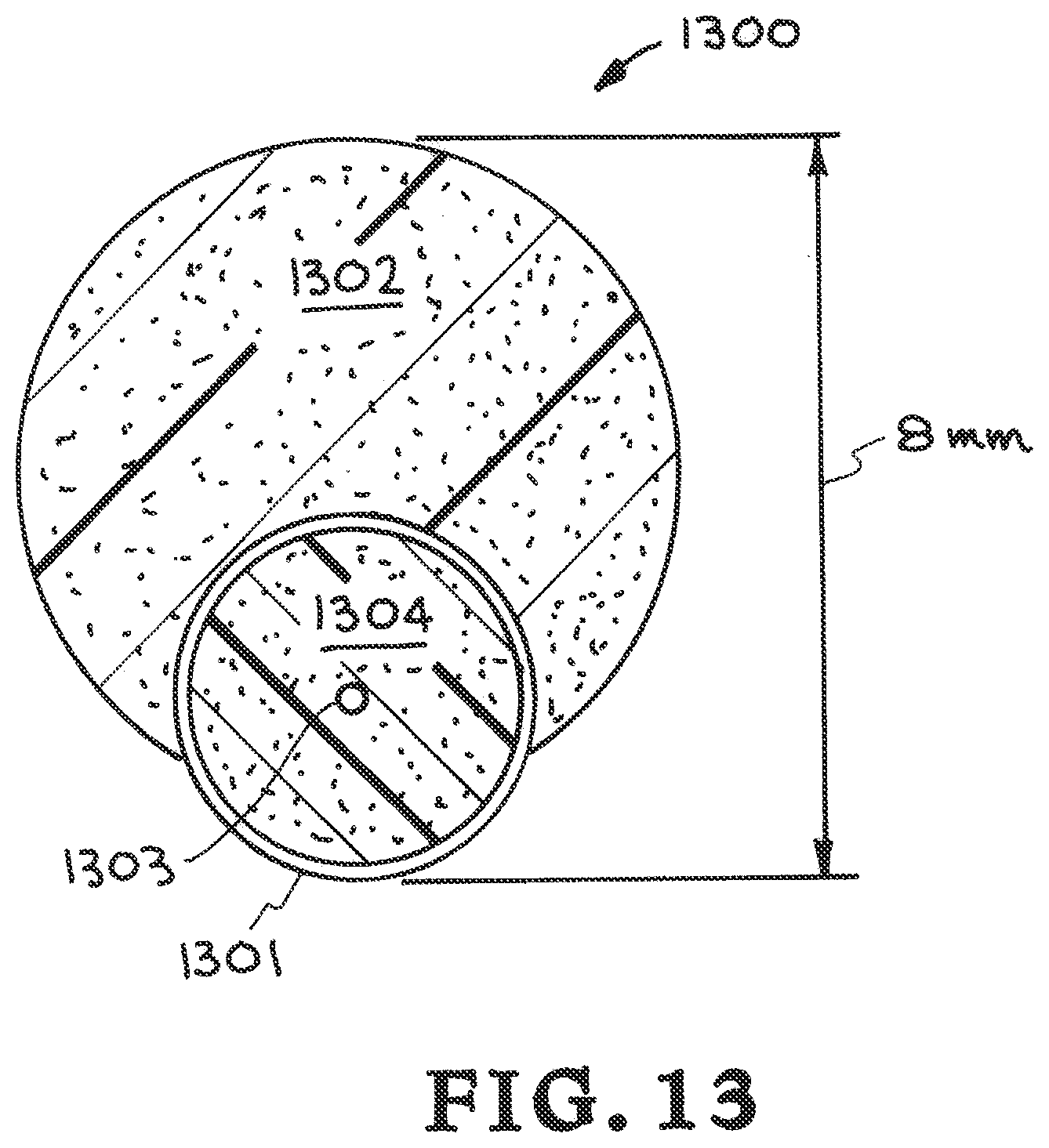 Patent US12310835 Figure 6 – Stent with expandable foam