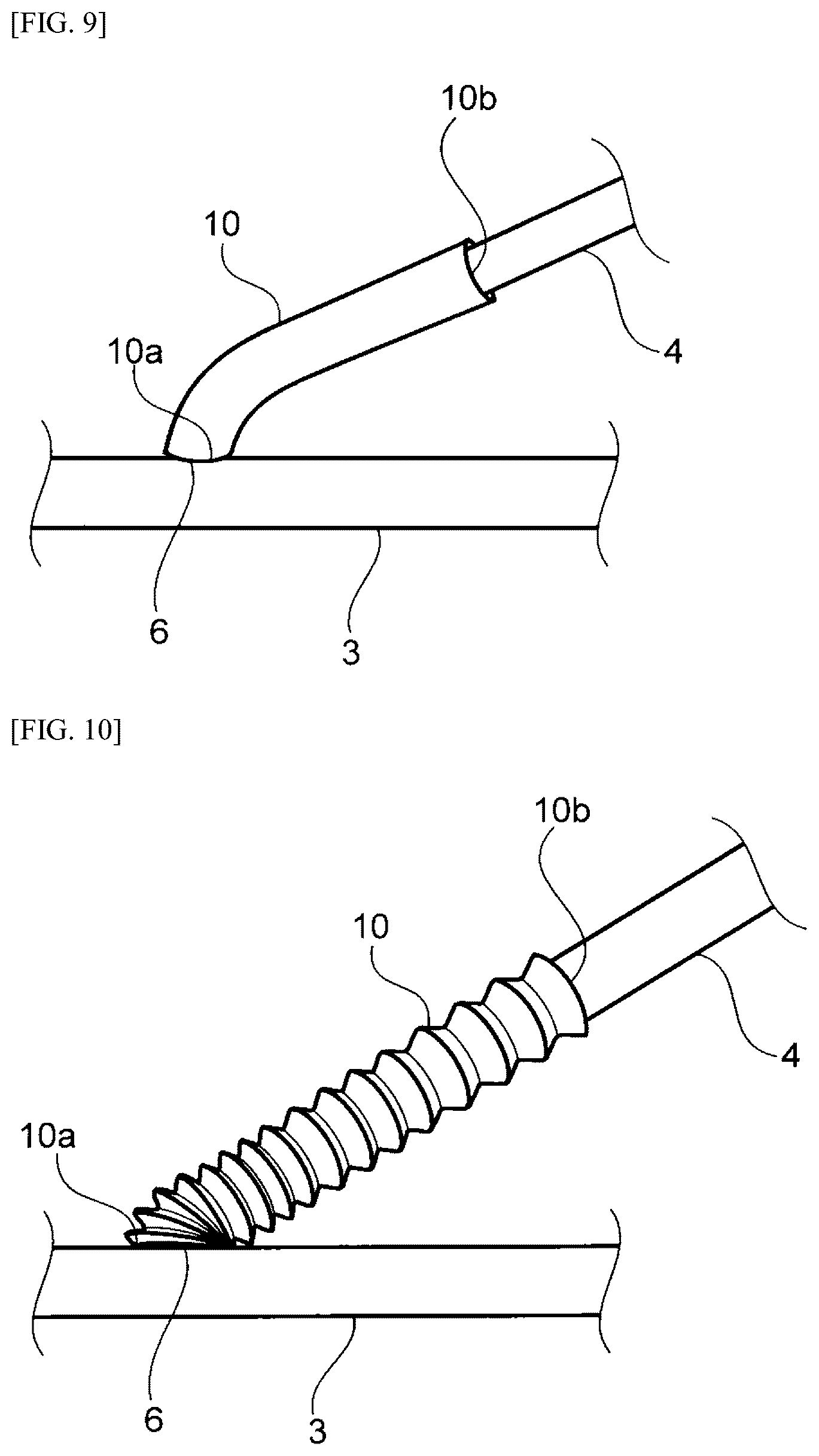 Patent US12310836 Figure 5 – Vein cover