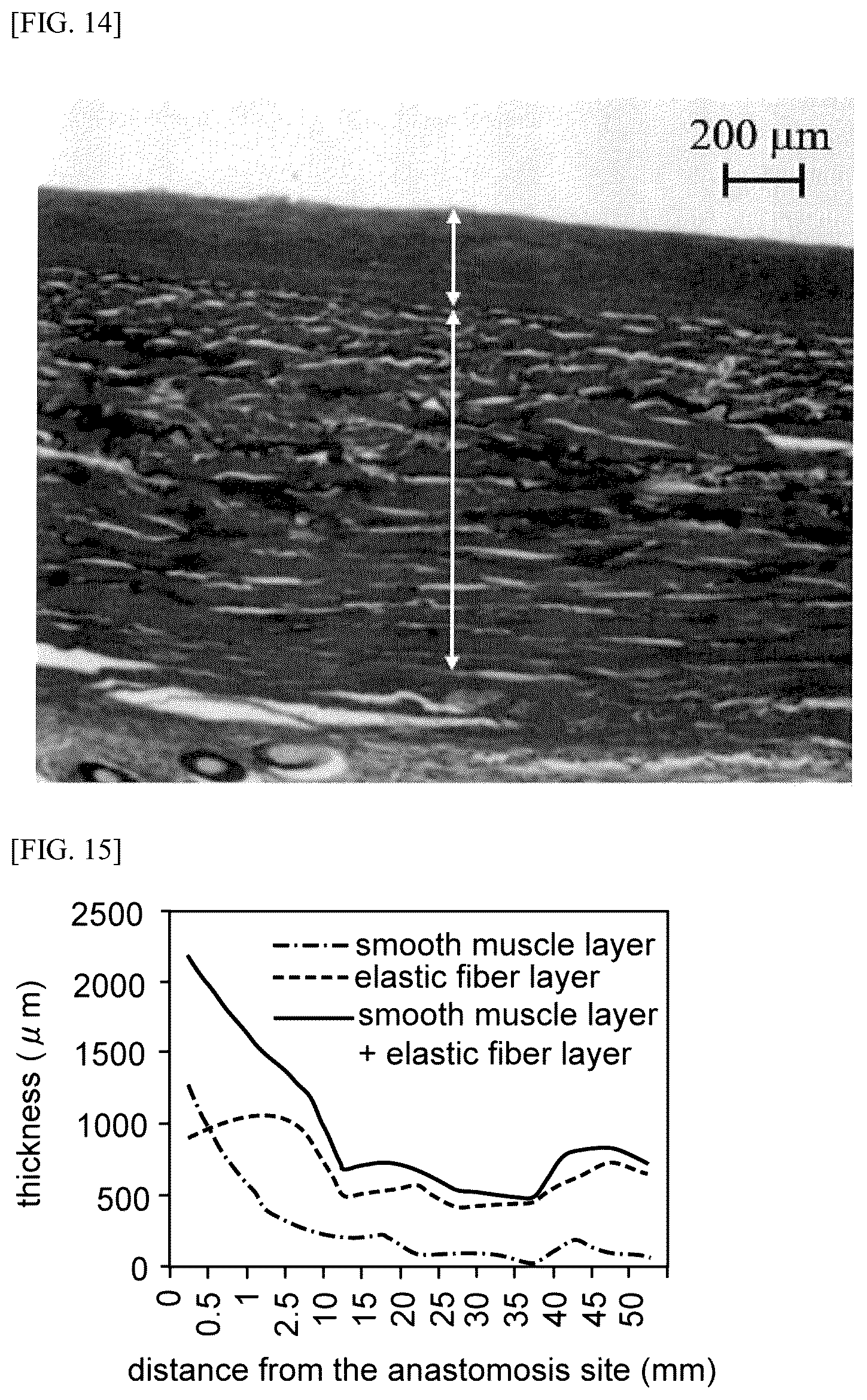 Patent US12310836 Figure 7 – Vein cover