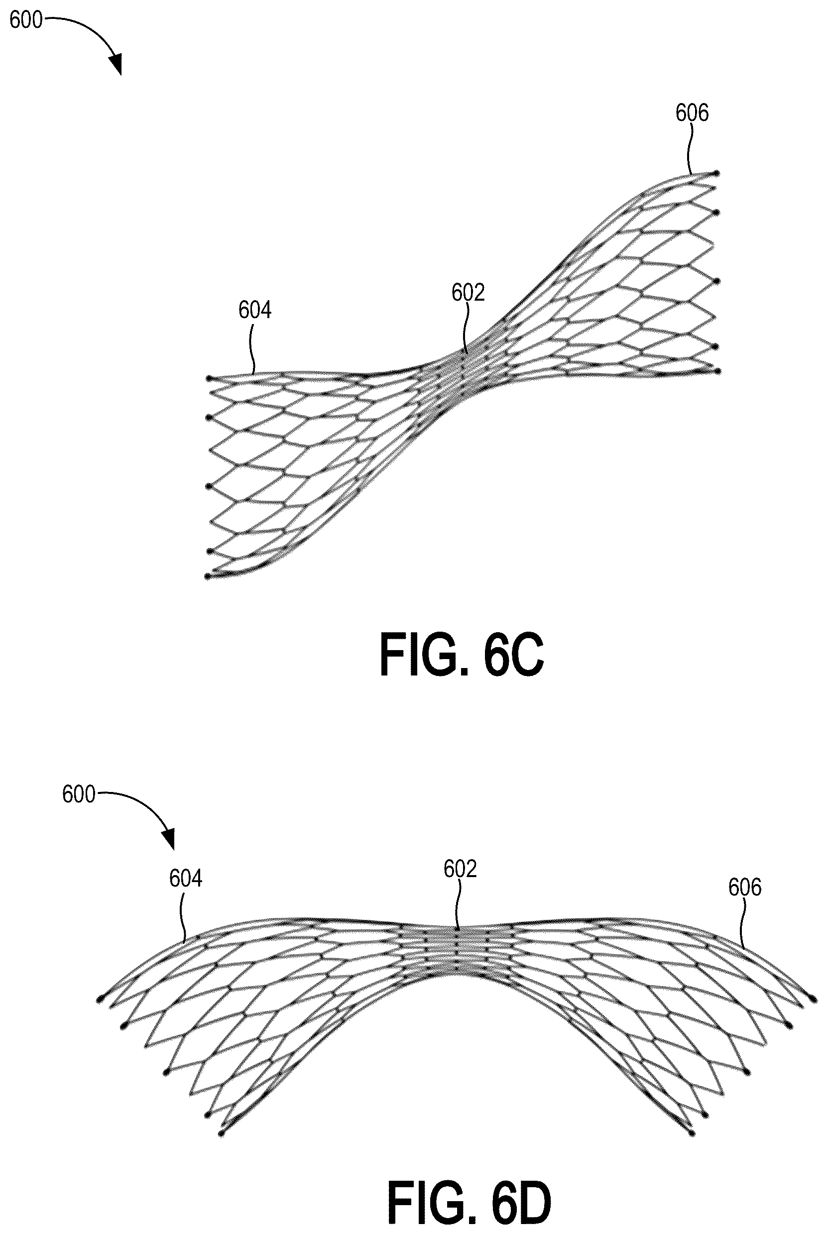 Patent US12310837 Figure 11 – Methods and systems for transcaval treatment of aneurysms