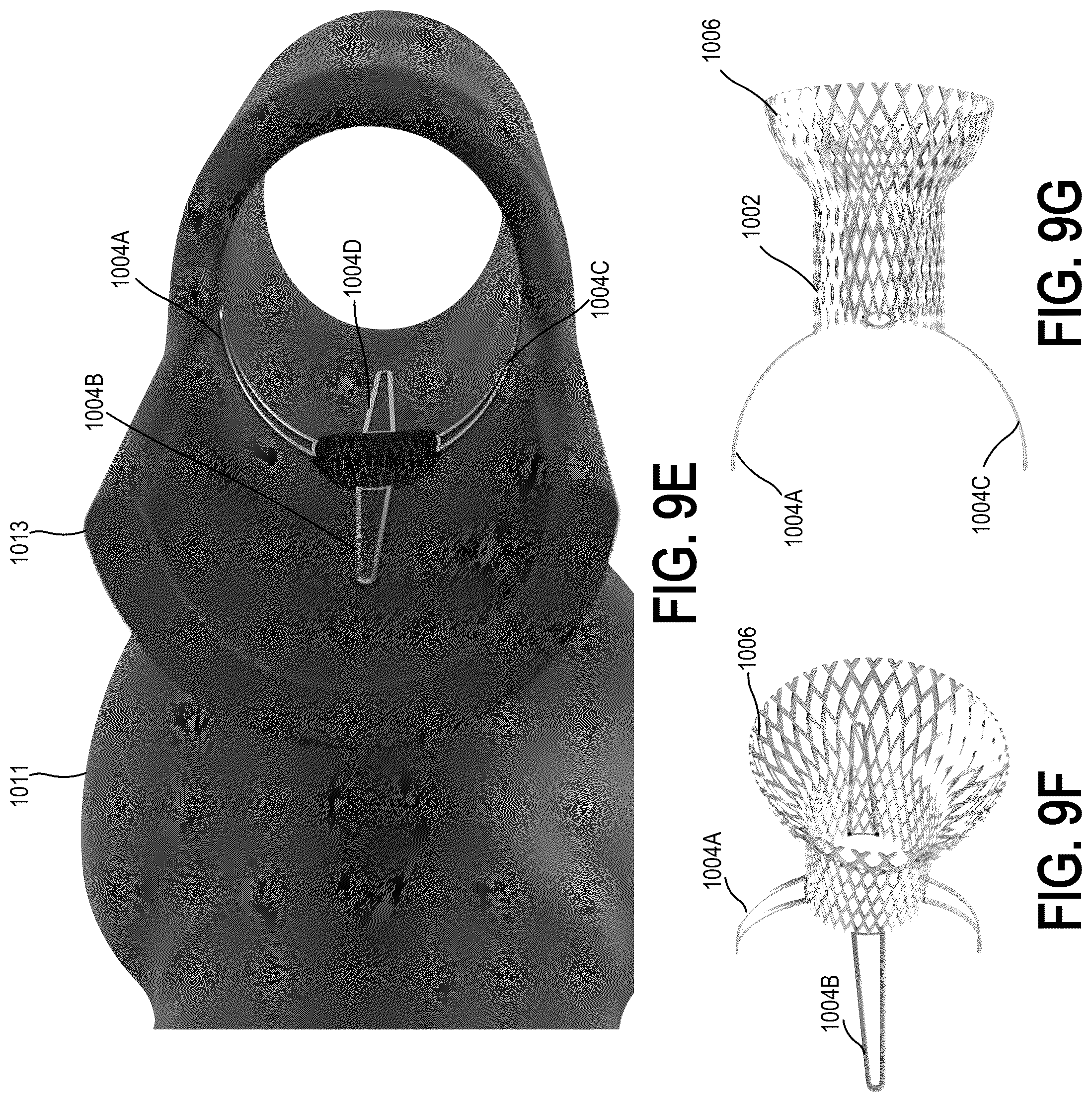 Patent US12310837 Figure 19 – Methods and systems for transcaval treatment of aneurysms