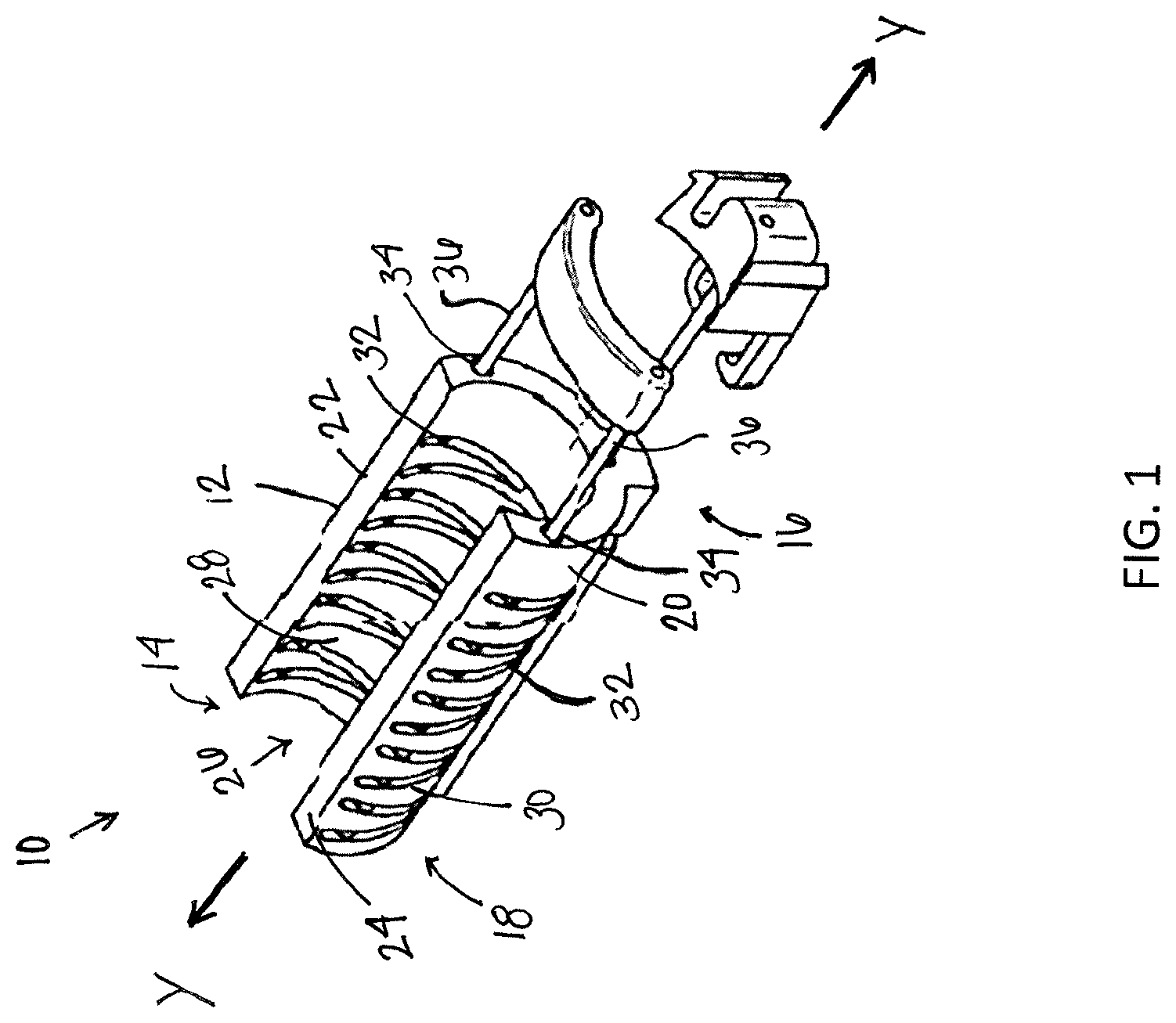 Patent US12310838 Figure 1 – System and method for preparing a soft tissue graft
