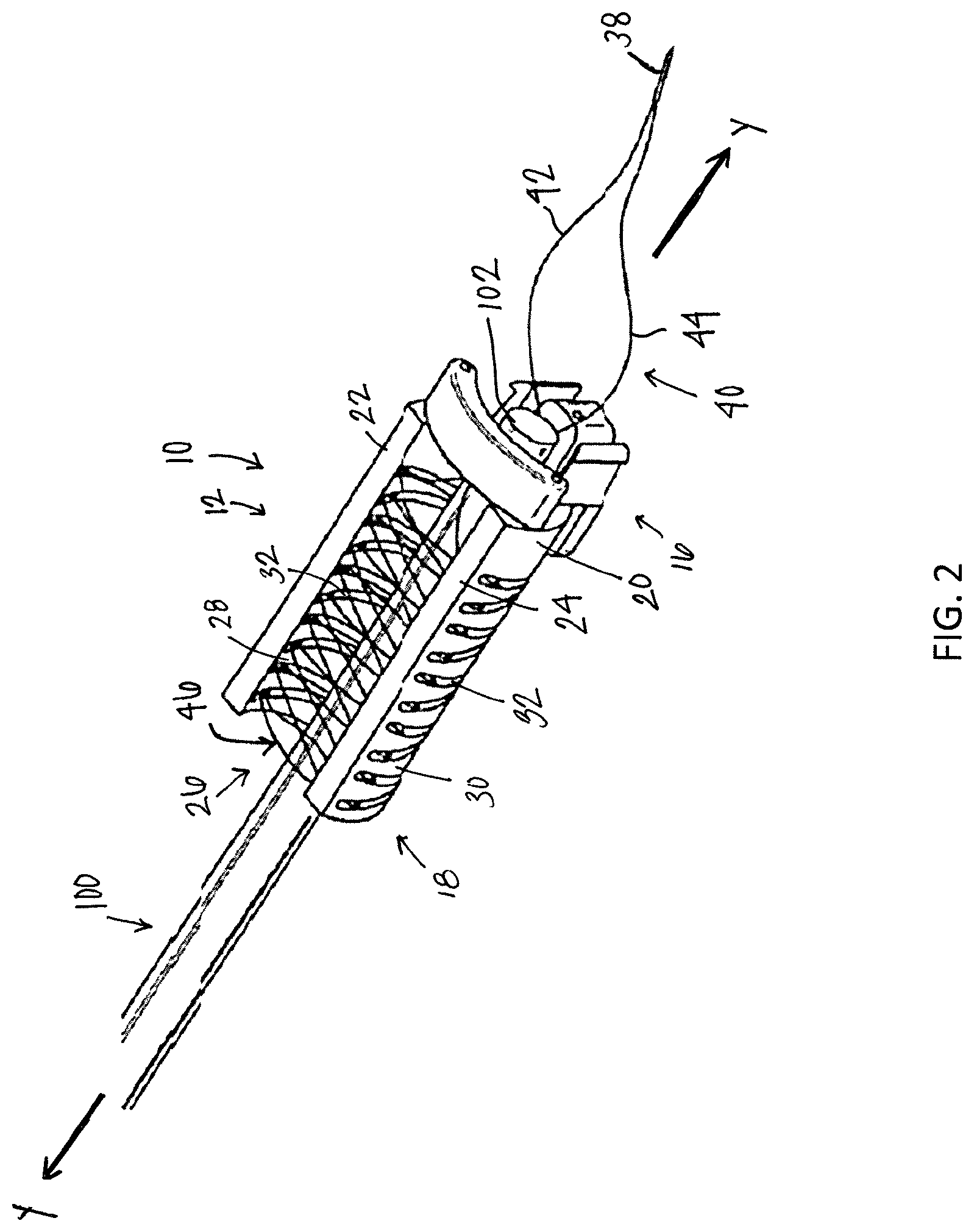 Patent US12310838 Figure 2 – System and method for preparing a soft tissue graft