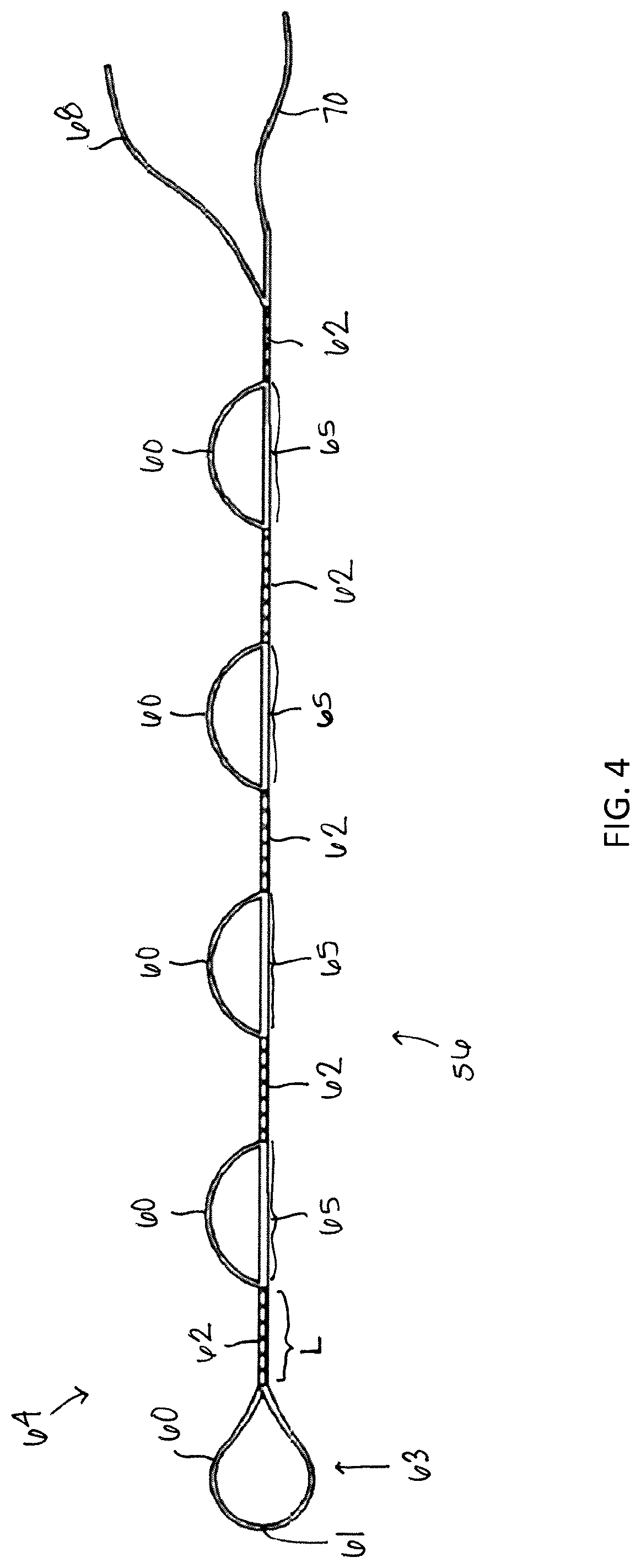 Patent US12310838 Figure 4 – System and method for preparing a soft tissue graft