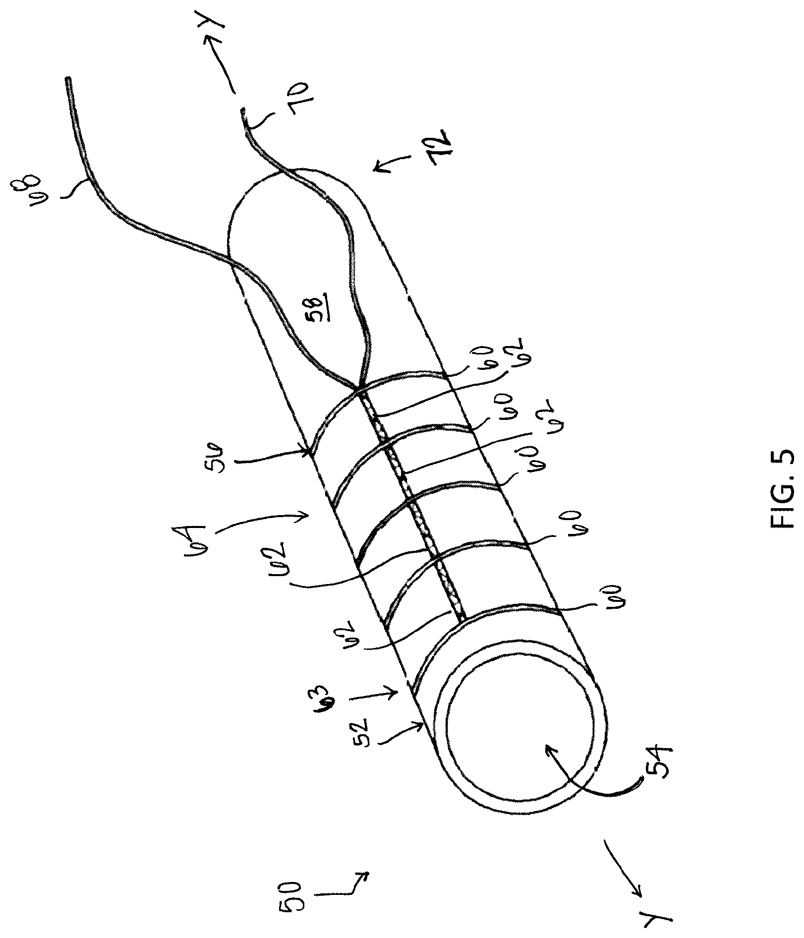 Patent US12310838 Figure 5 – System and method for preparing a soft tissue graft