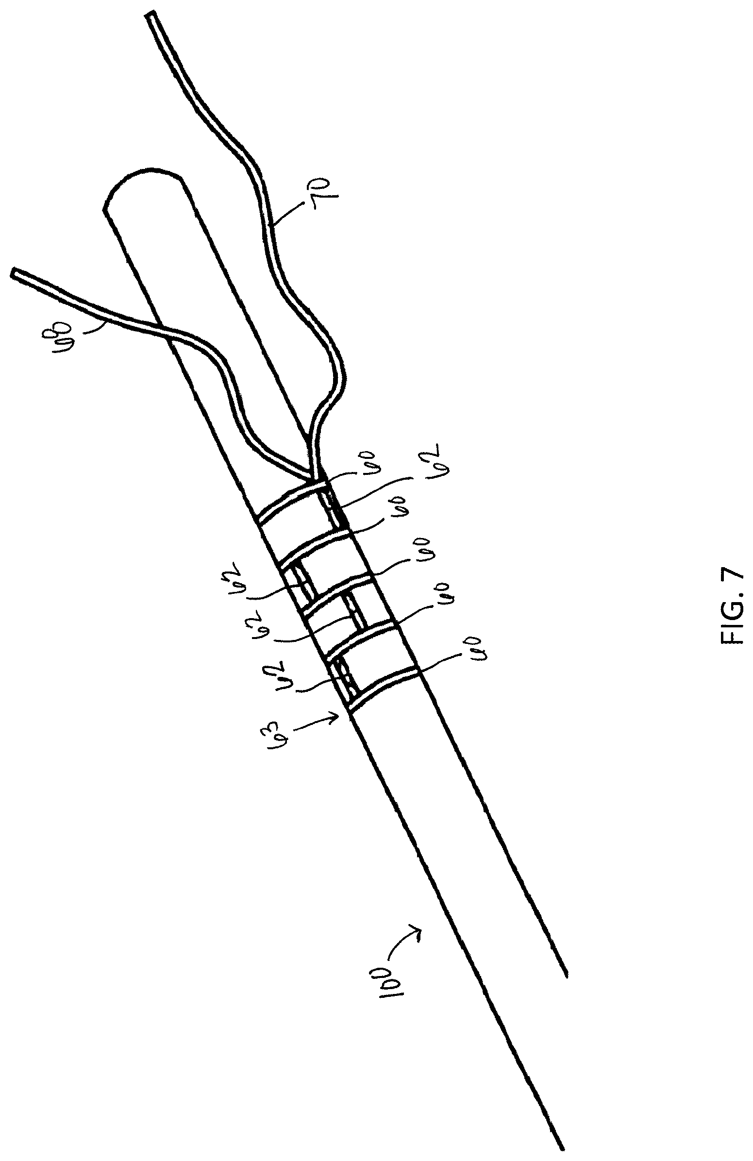 Patent US12310838 Figure 7 – System and method for preparing a soft tissue graft