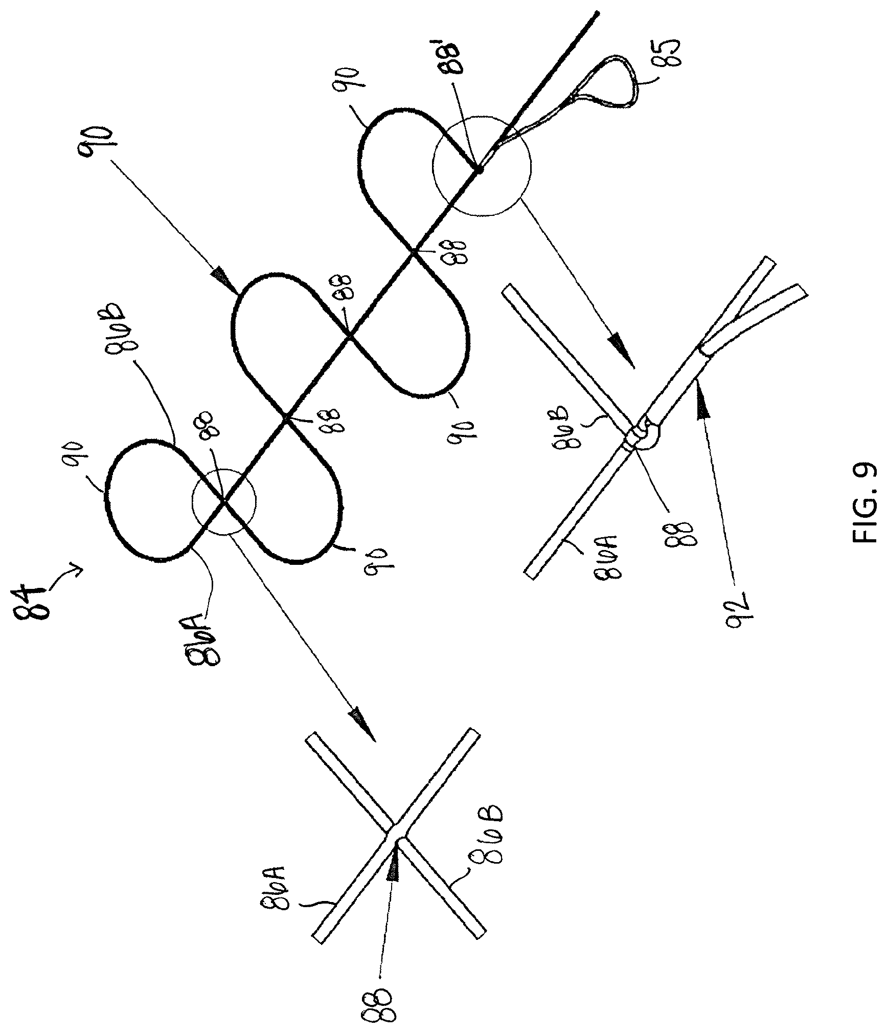 Patent US12310838 Figure 9 – System and method for preparing a soft tissue graft