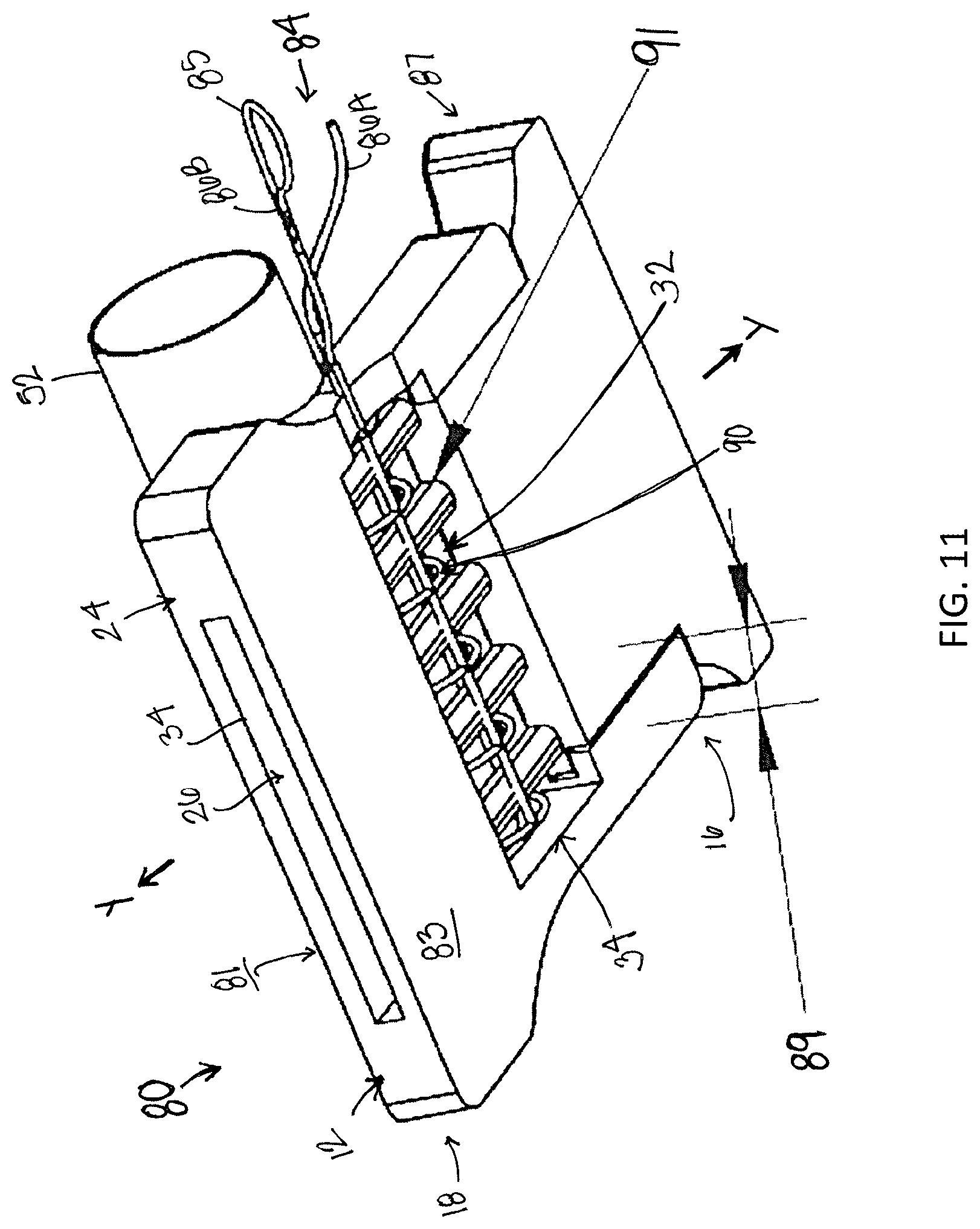Patent US12310838 Figure 11 – System and method for preparing a soft tissue graft