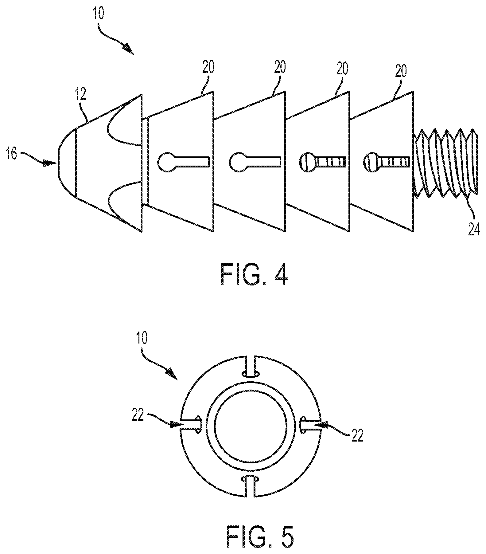 Patent US12310839 Figure 3 – Expanding anchor