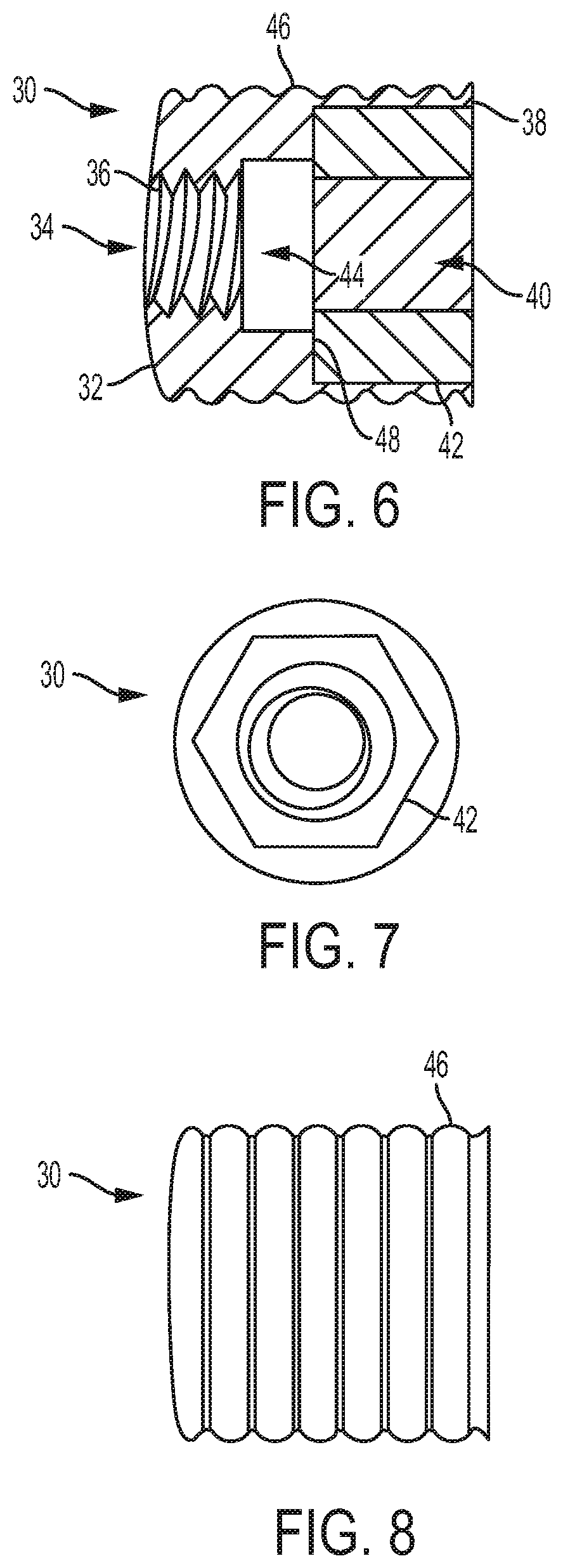 Patent US12310839 Figure 4 – Expanding anchor