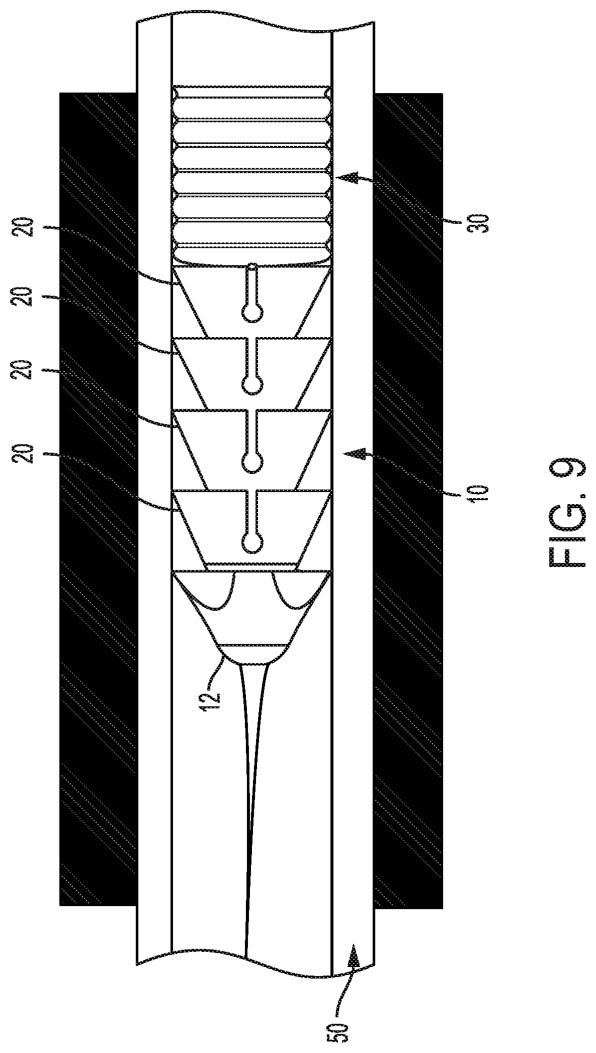 Patent US12310839 Figure 5 – Expanding anchor
