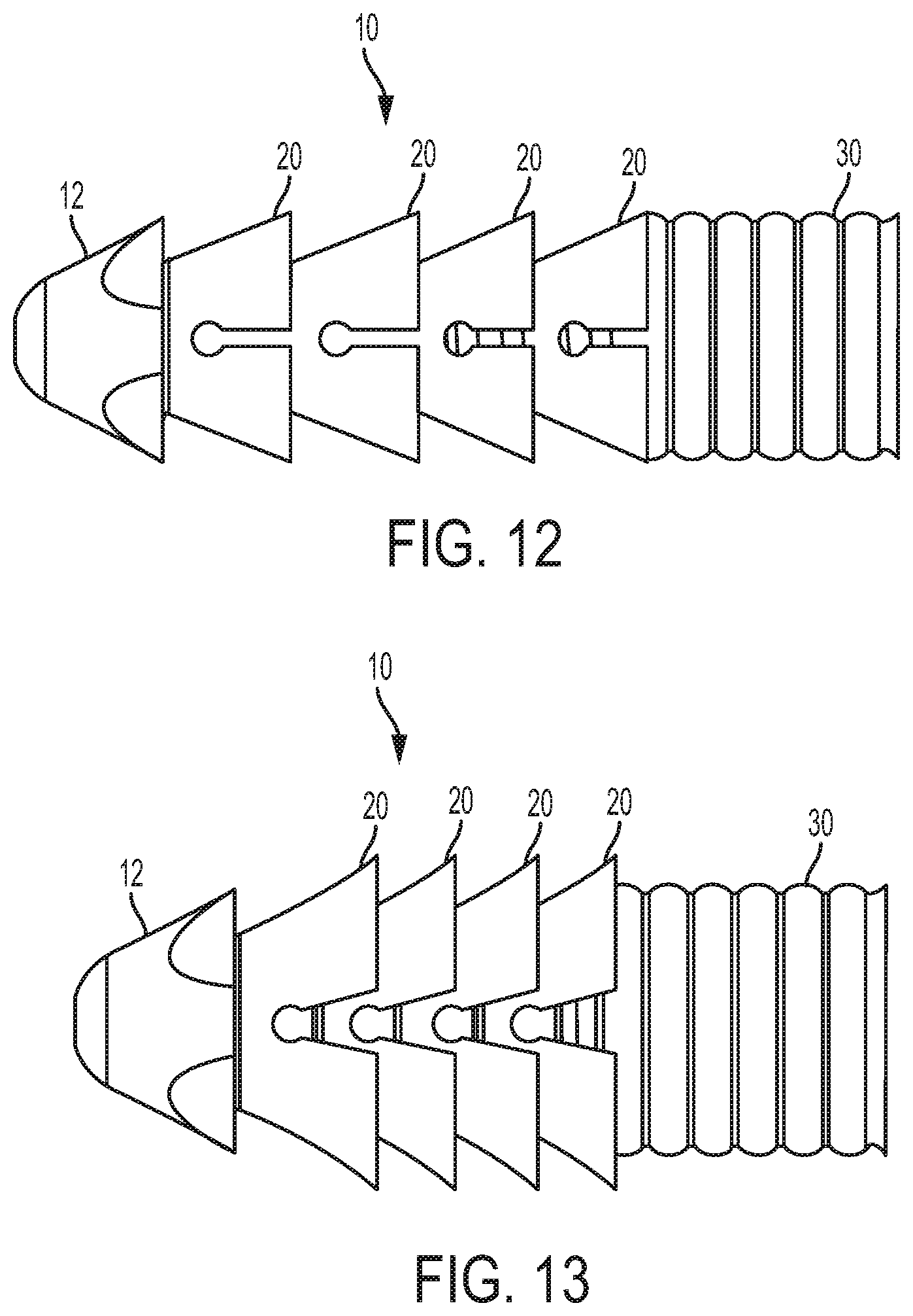 Patent US12310839 Figure 7 – Expanding anchor
