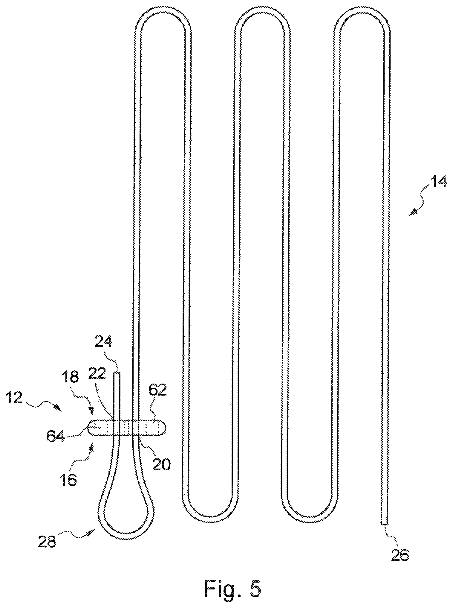 Patent US12310840 Figure 5 – Implant assembly and associated methods of manufacturing