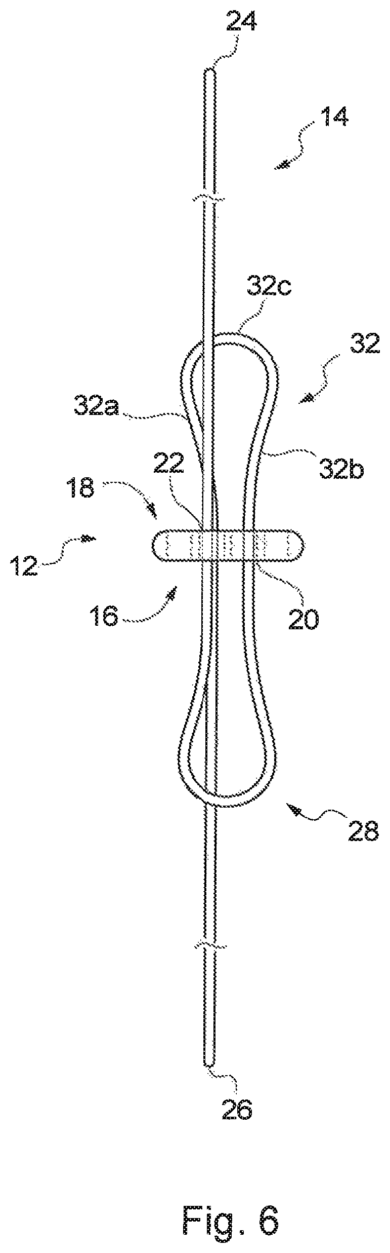 Patent US12310840 Figure 6 – Implant assembly and associated methods of manufacturing