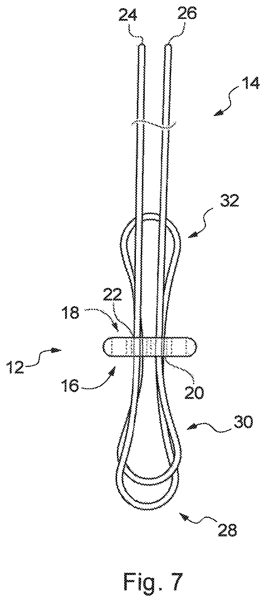 Patent US12310840 Figure 7 – Implant assembly and associated methods of manufacturing
