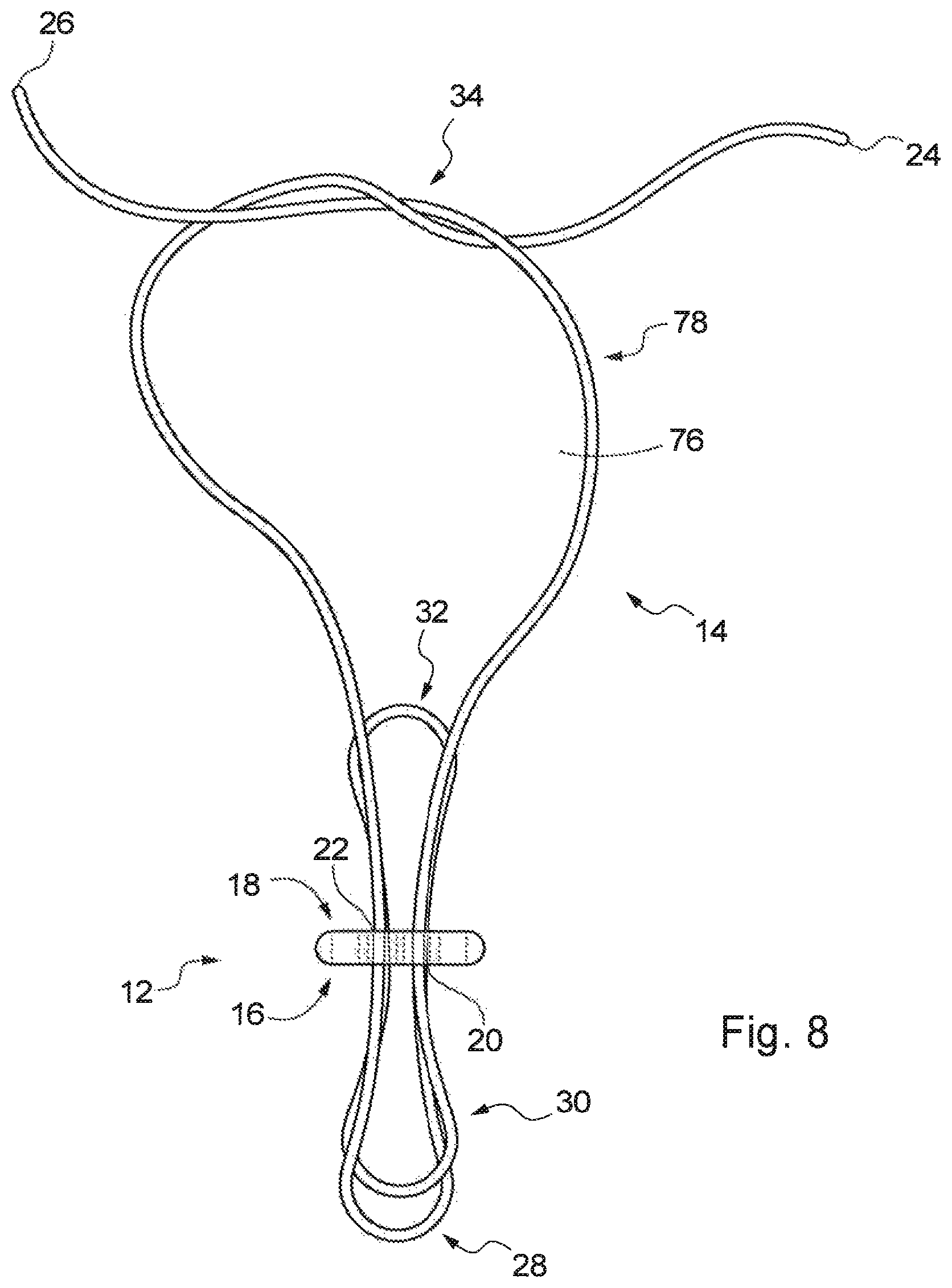 Patent US12310840 Figure 8 – Implant assembly and associated methods of manufacturing
