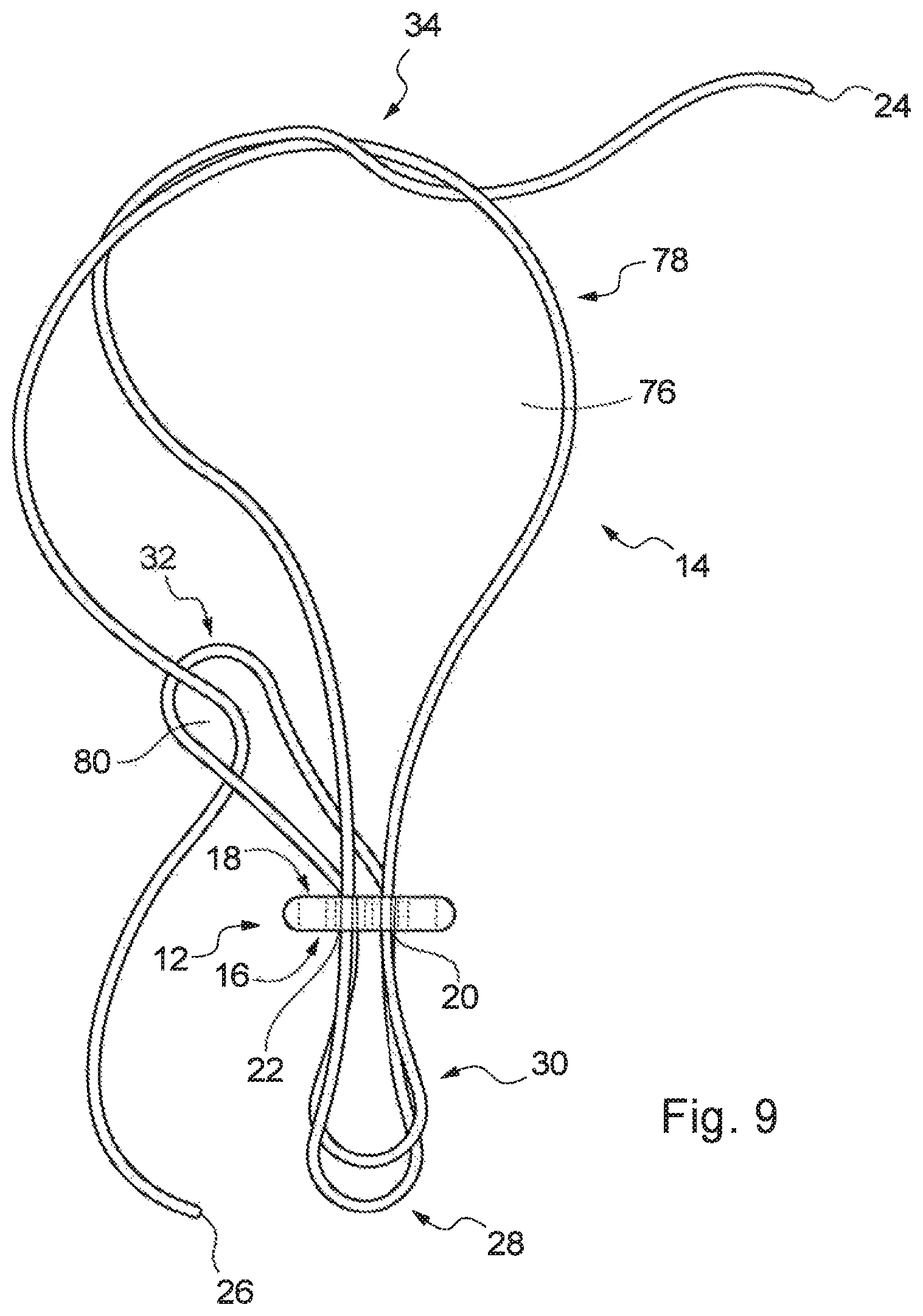 Patent US12310840 Figure 9 – Implant assembly and associated methods of manufacturing