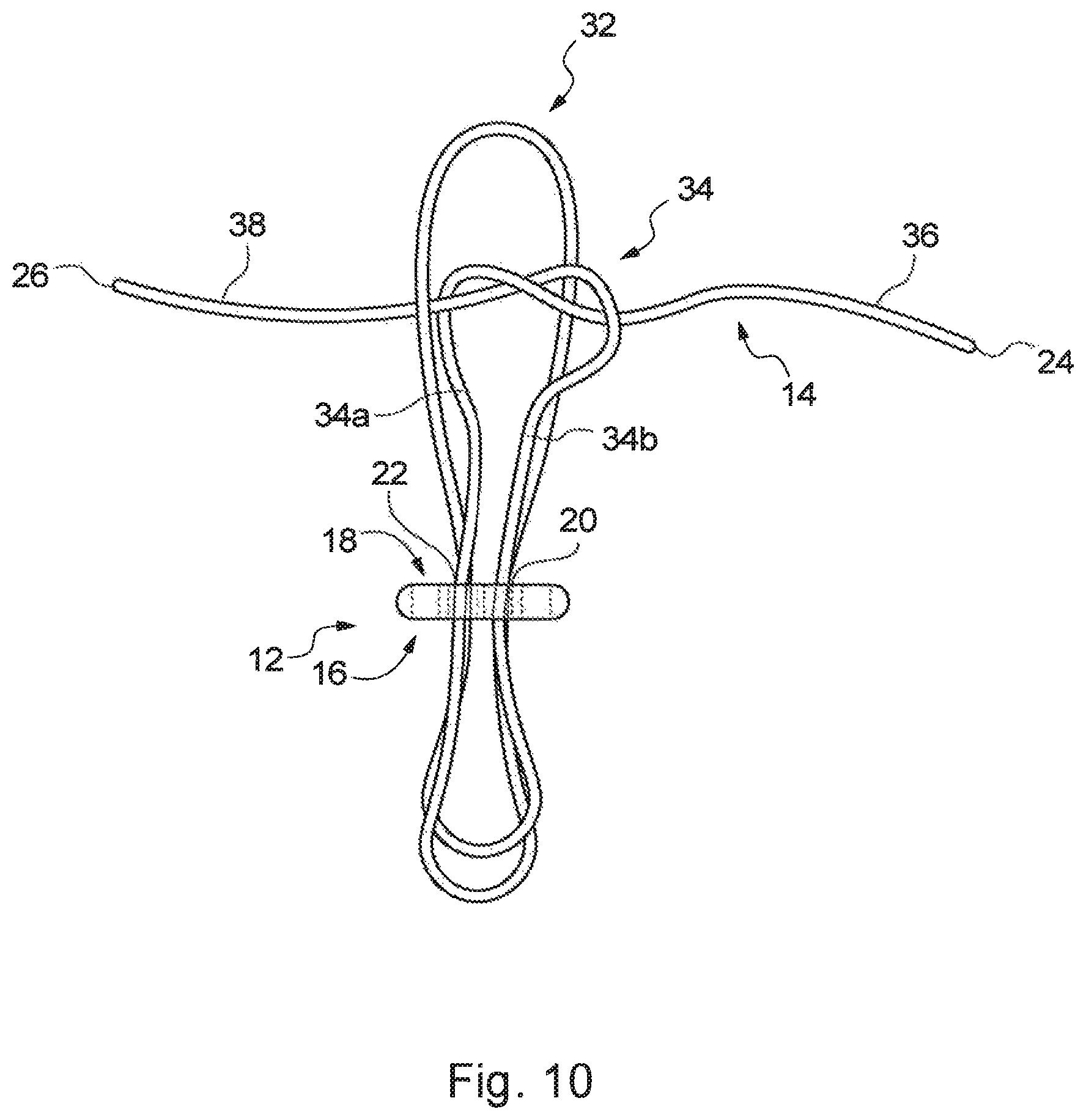 Patent US12310840 Figure 10 – Implant assembly and associated methods of manufacturing