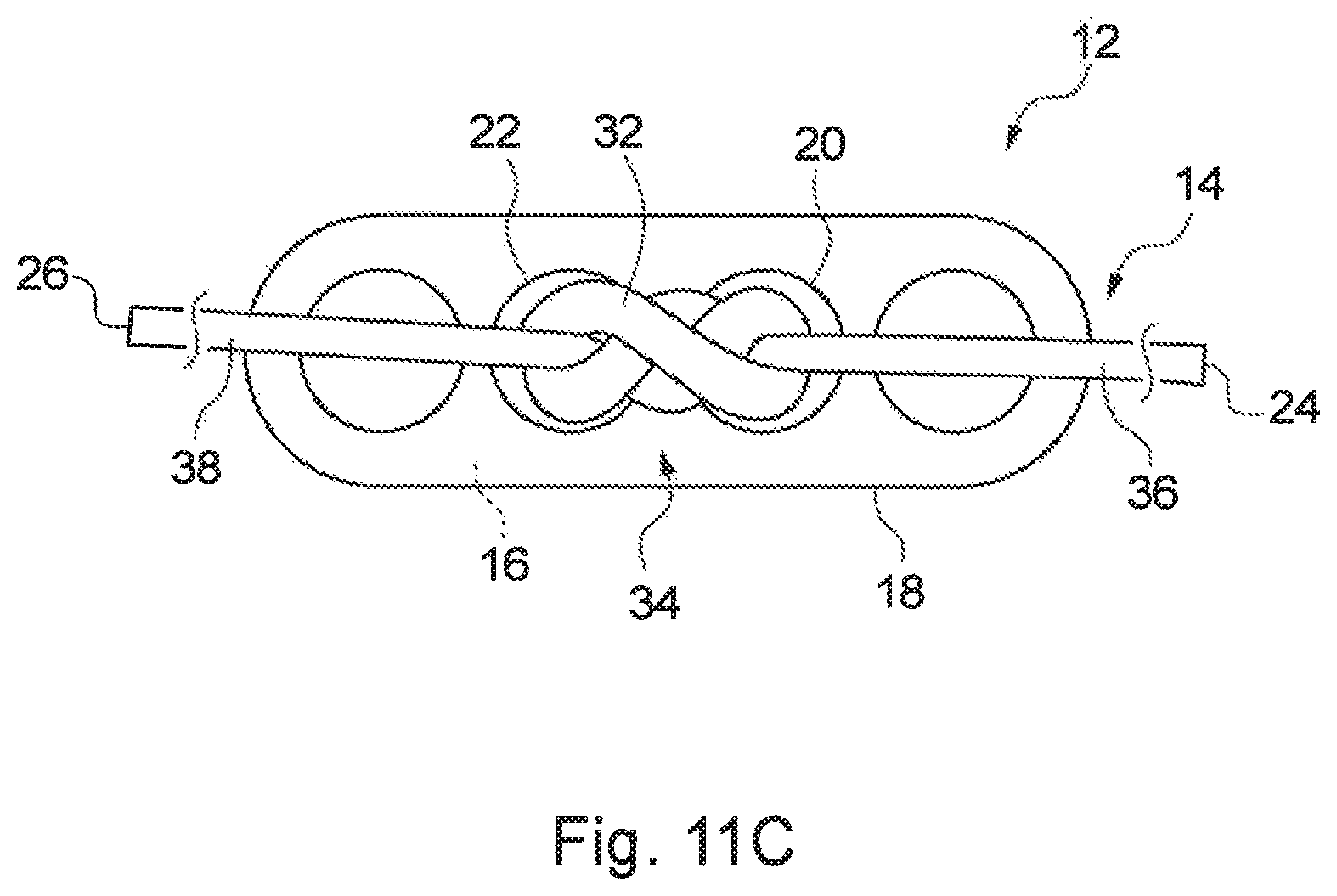 Patent US12310840 Figure 14 – Implant assembly and associated methods of manufacturing