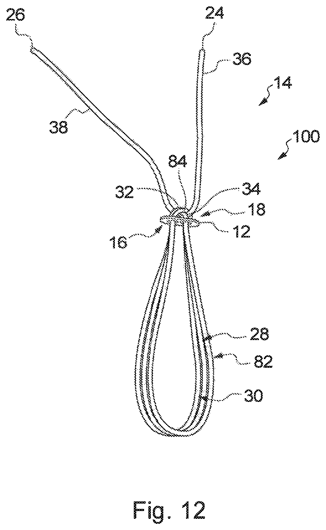 Patent US12310840 Figure 16 – Implant assembly and associated methods of manufacturing