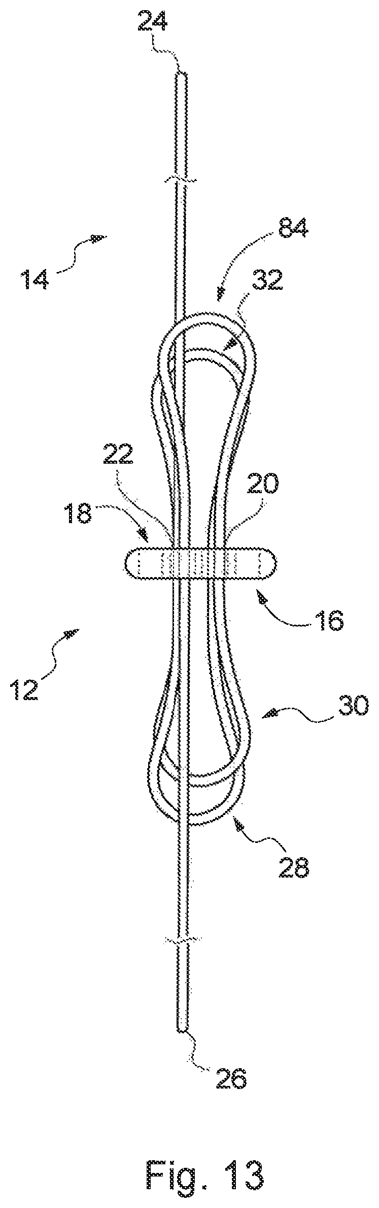 Patent US12310840 Figure 17 – Implant assembly and associated methods of manufacturing