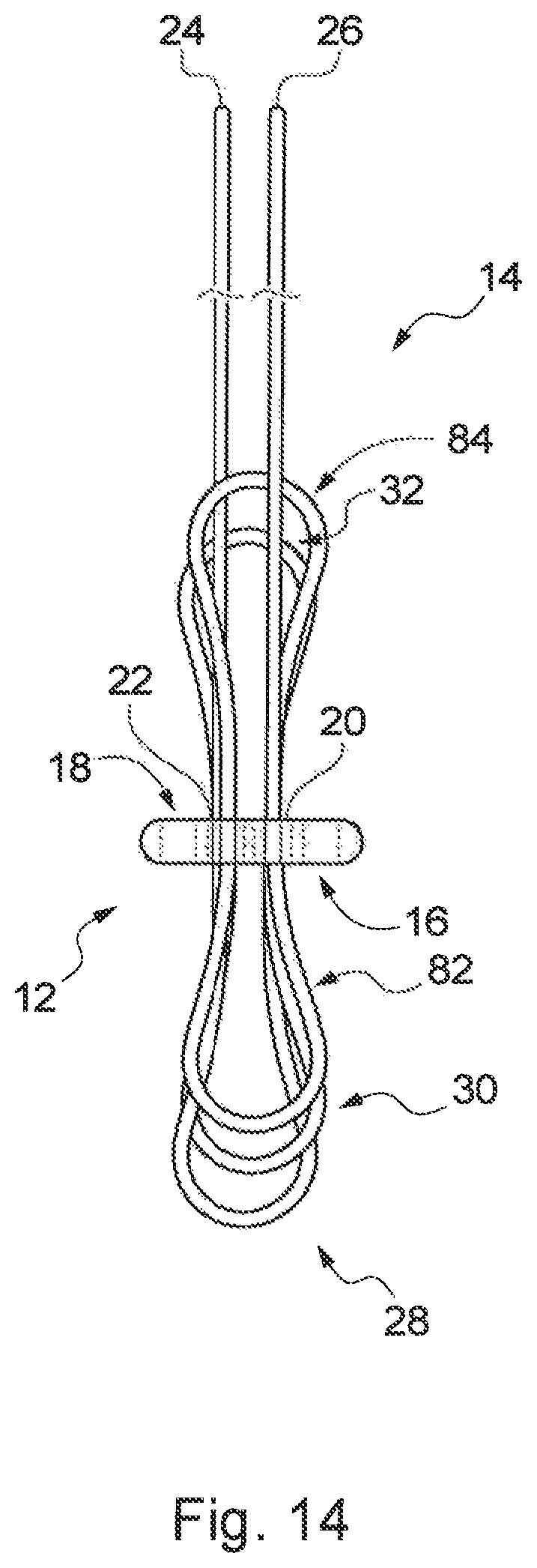 Patent US12310840 Figure 18 – Implant assembly and associated methods of manufacturing