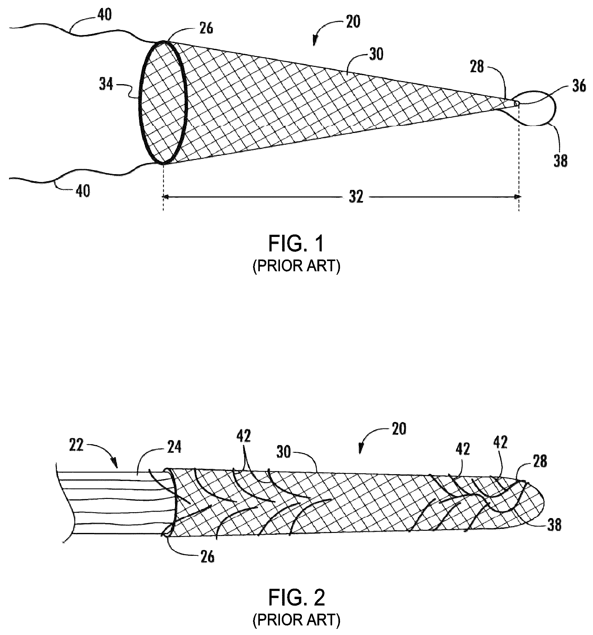 Patent US12310841 — Fibrous connective tissue protective device, method of manufacturing, and surgical method — Figure 1