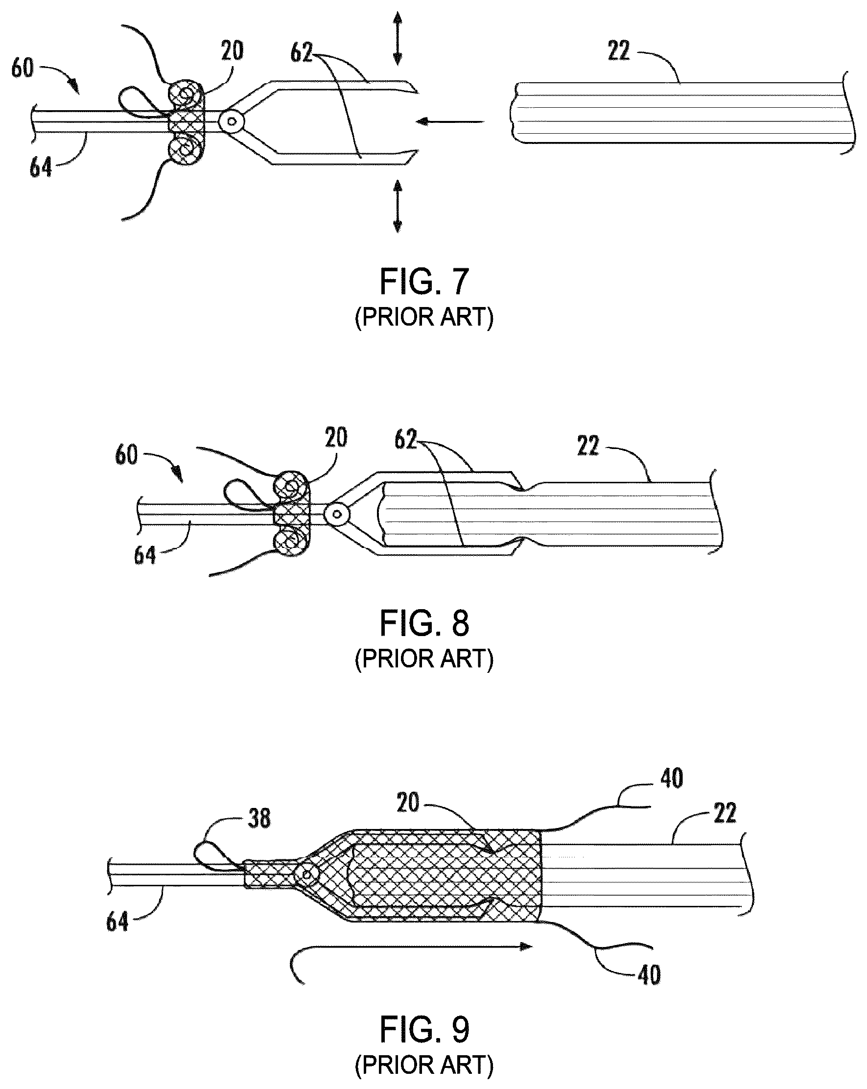 Patent US12310841 Figure 4 – Fibrous connective tissue protective device, method of manufacturing, and surgical method