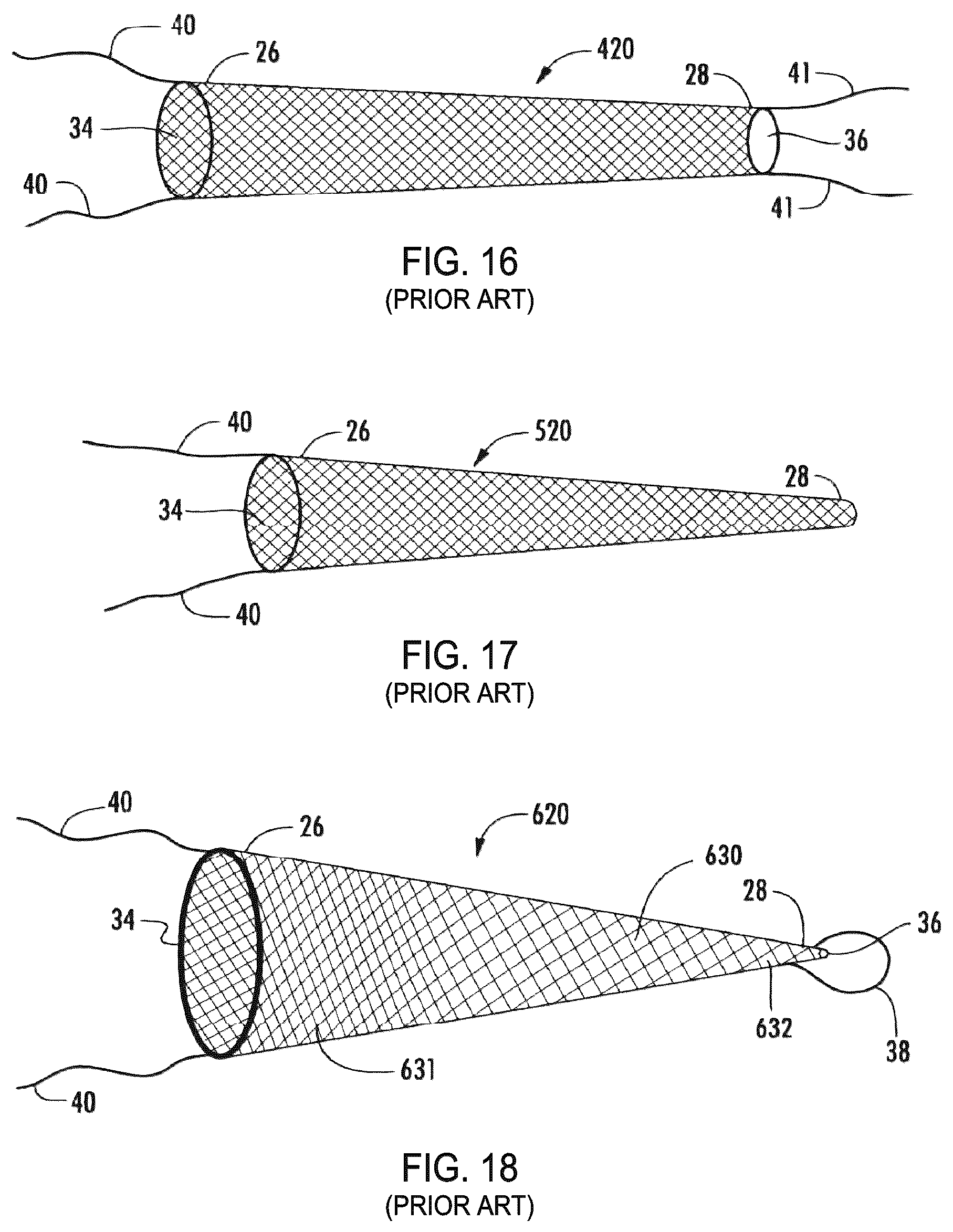 Patent US12310841 Figure 7 – Fibrous connective tissue protective device, method of manufacturing, and surgical method