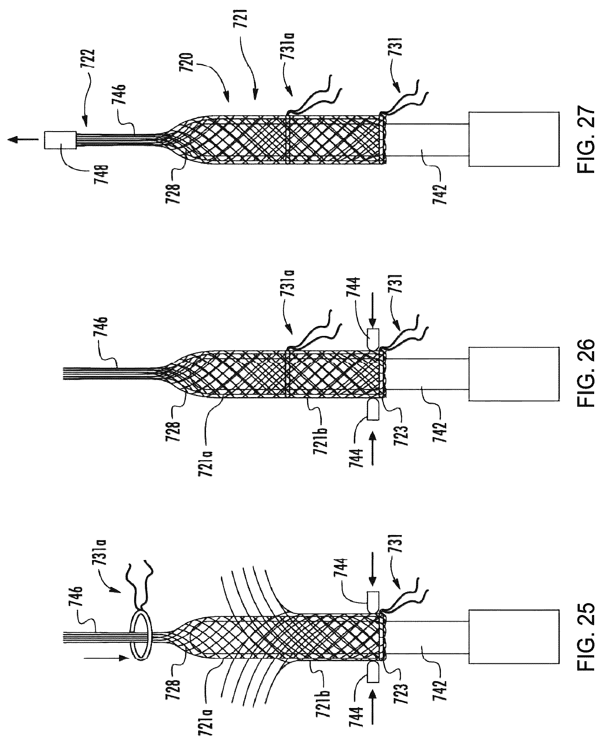 Patent US12310841 Figure 10 – Fibrous connective tissue protective device, method of manufacturing, and surgical method