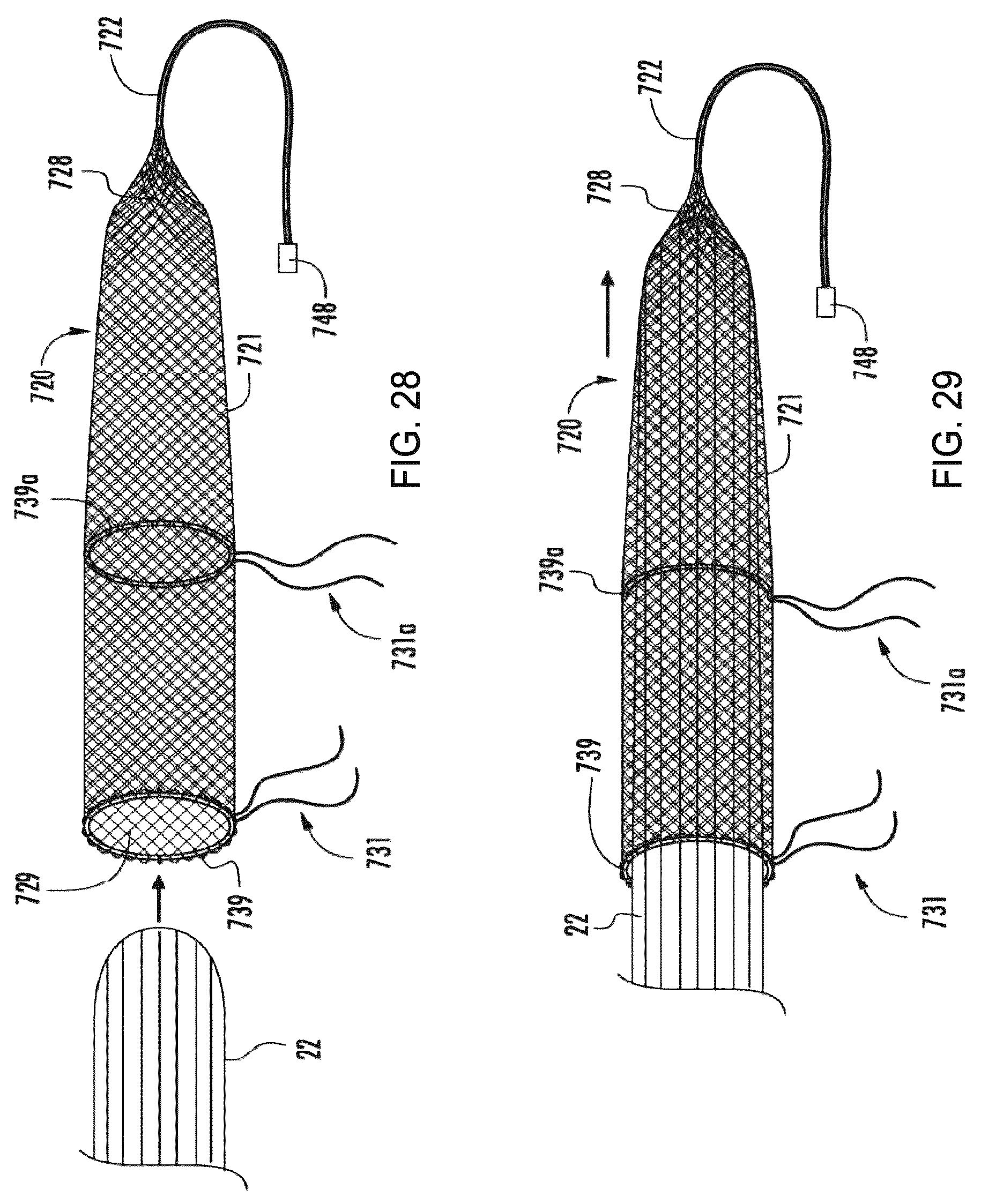 Patent US12310841 Figure 11 – Fibrous connective tissue protective device, method of manufacturing, and surgical method