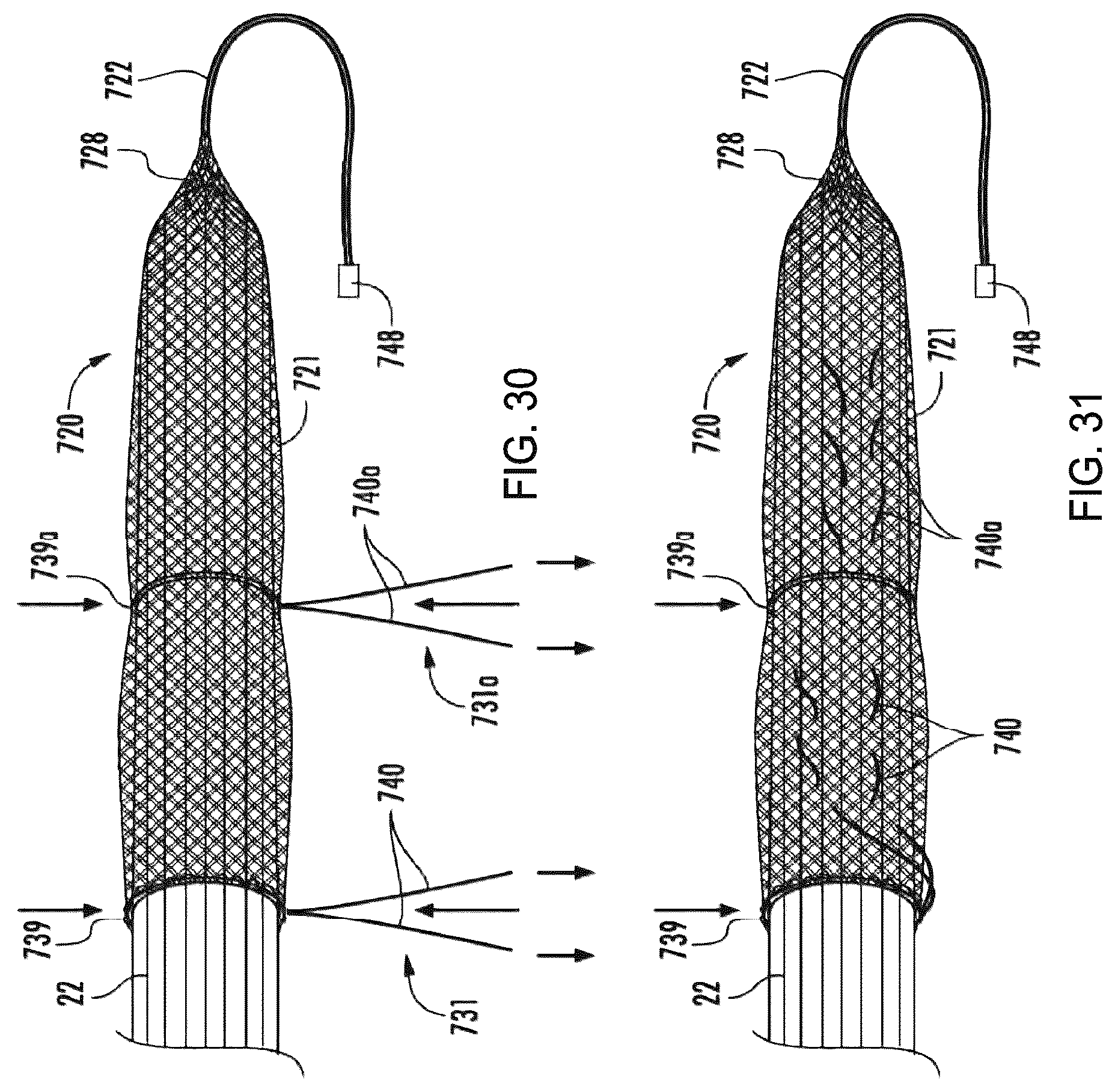 Patent US12310841 Figure 12 – Fibrous connective tissue protective device, method of manufacturing, and surgical method