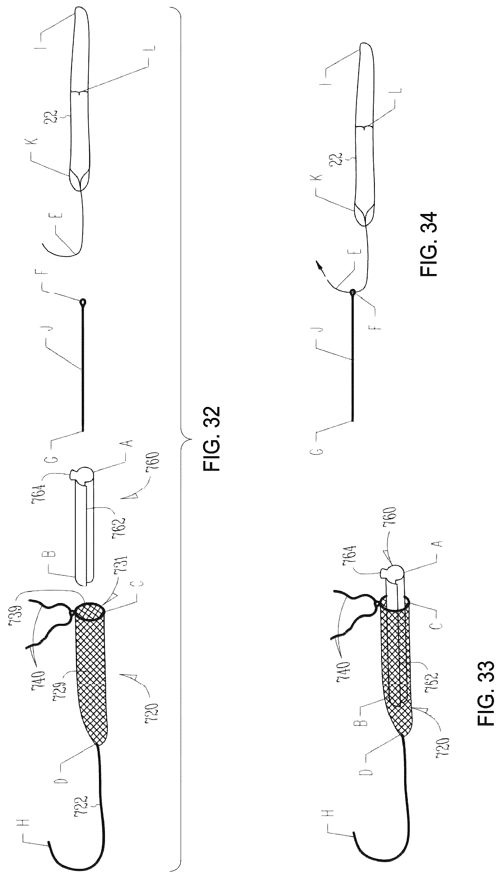 Patent US12310841 Figure 13 – Fibrous connective tissue protective device, method of manufacturing, and surgical method