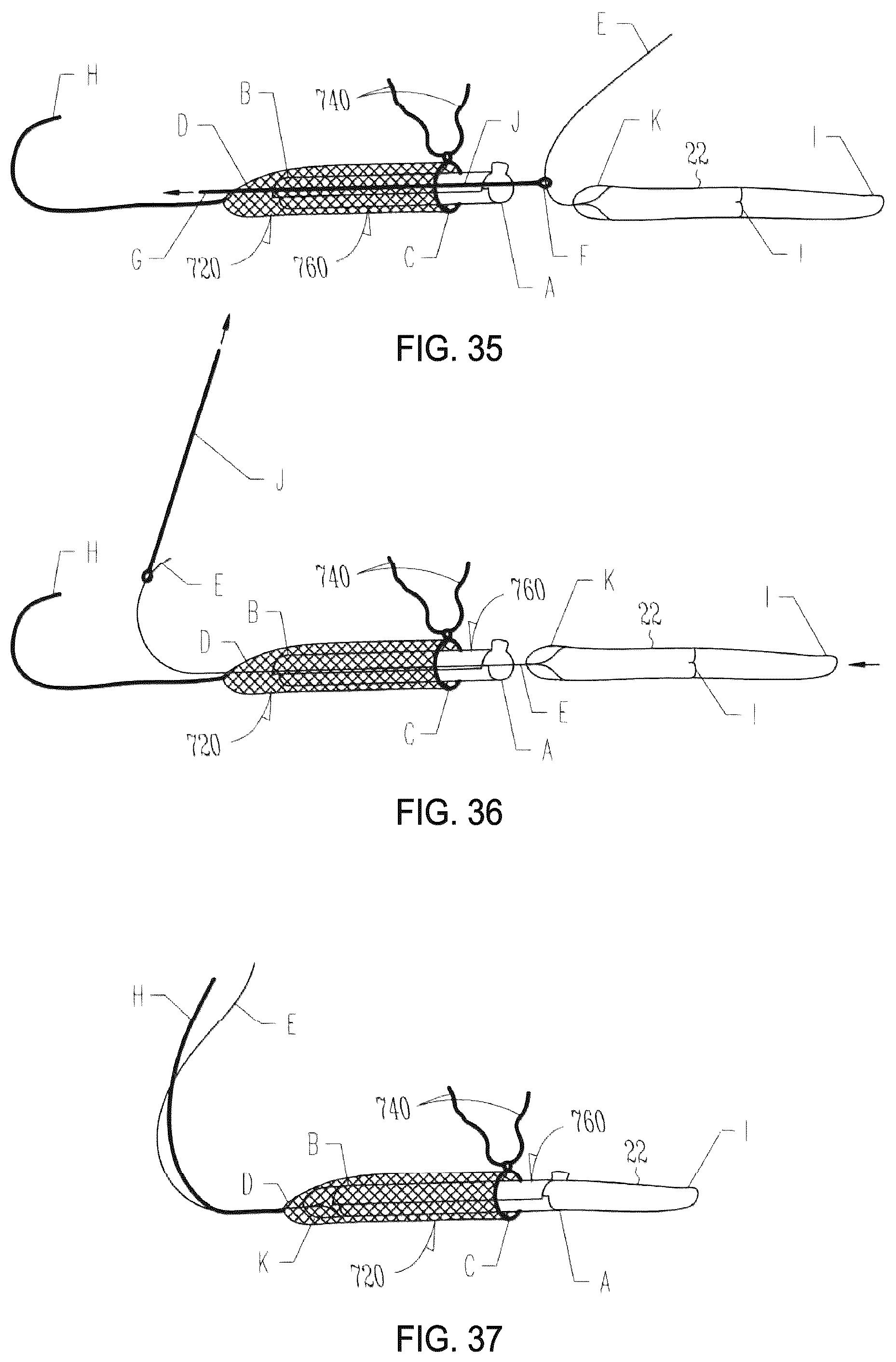 Patent US12310841 Figure 14 – Fibrous connective tissue protective device, method of manufacturing, and surgical method