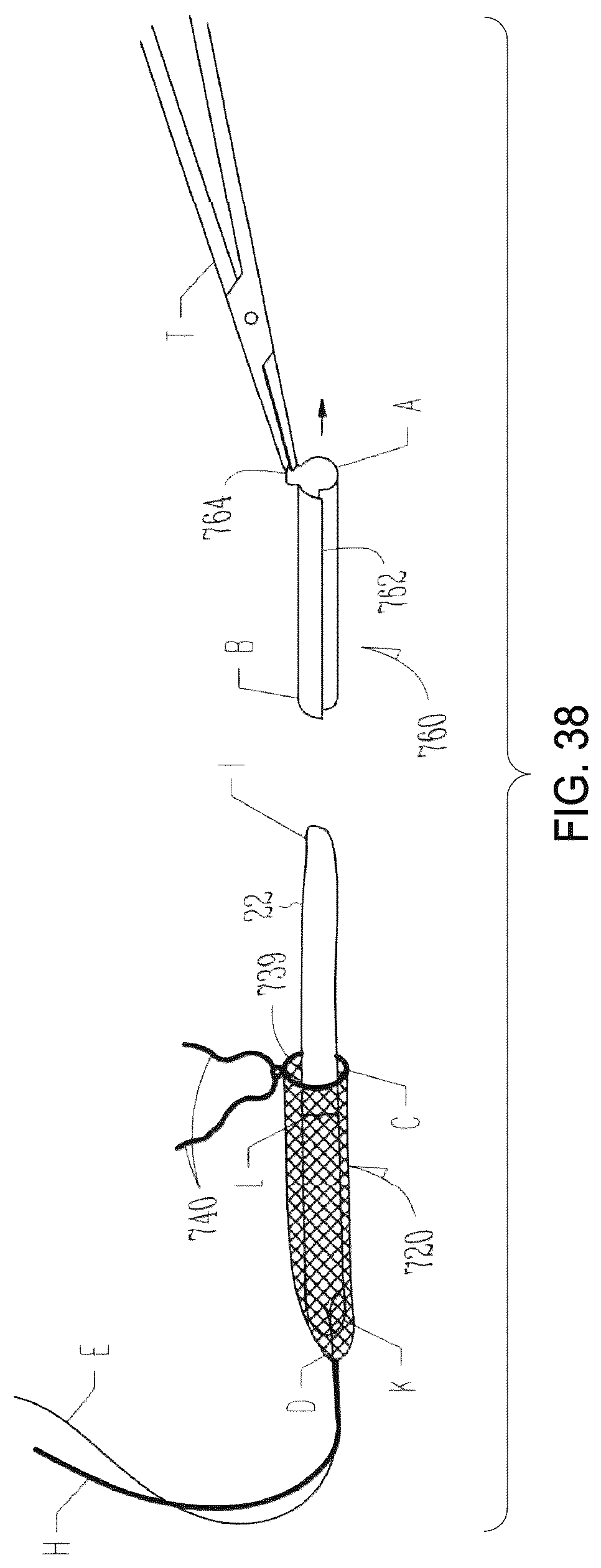 Patent US12310841 Figure 15 – Fibrous connective tissue protective device, method of manufacturing, and surgical method