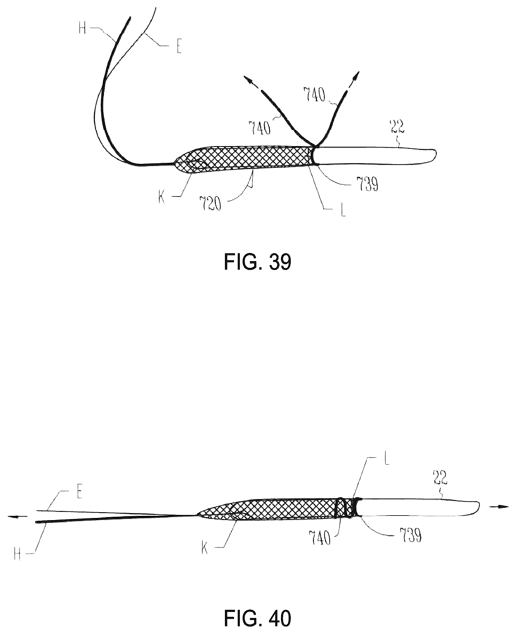Patent US12310841 Figure 16 – Fibrous connective tissue protective device, method of manufacturing, and surgical method