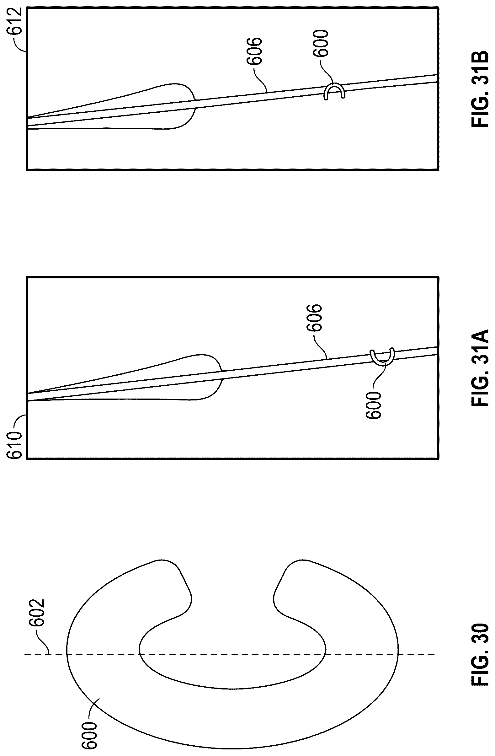 Patent US12310843 Figure 18 – Balloon cover for a delivery apparatus for an expandable prosthetic heart valve