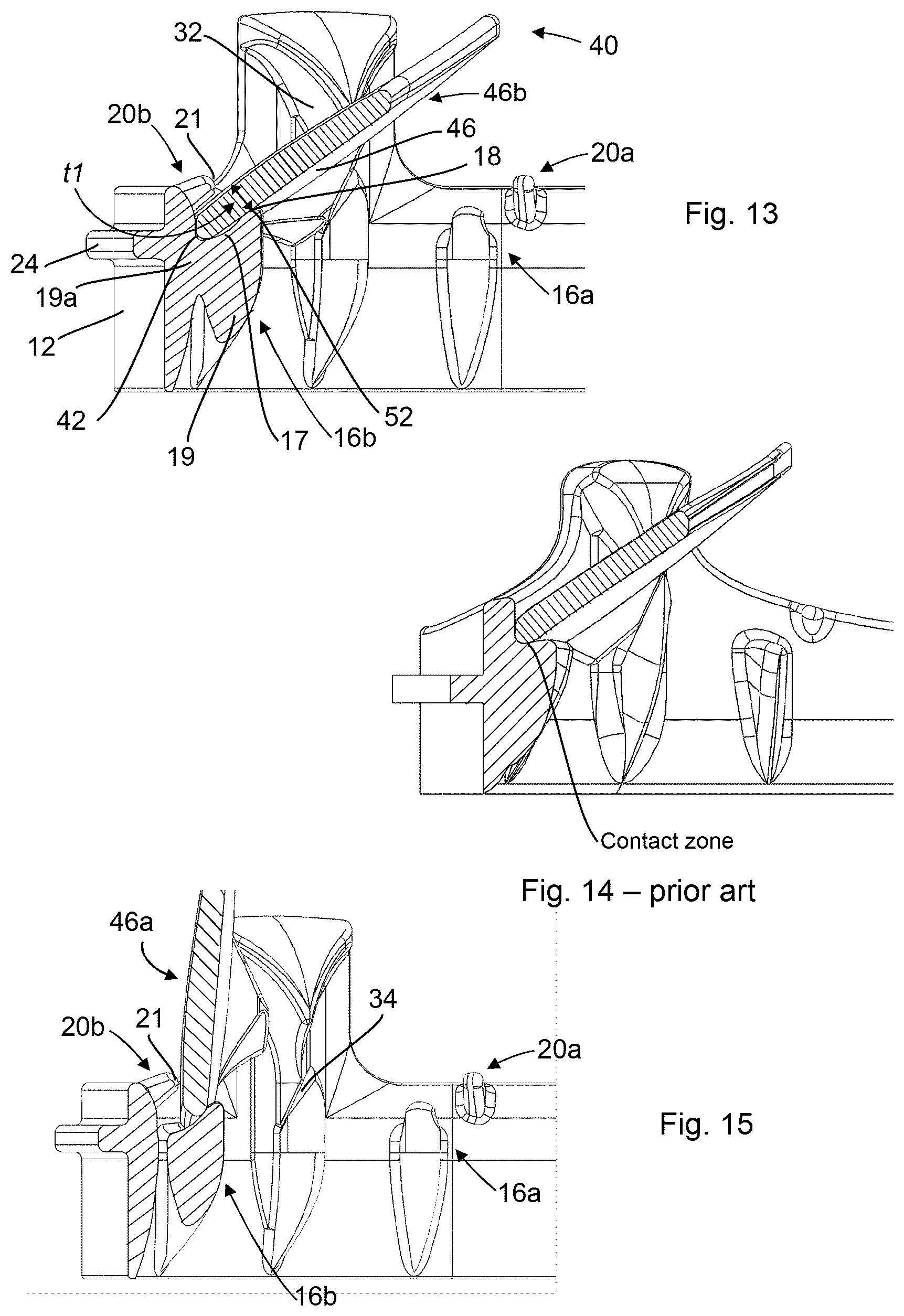 Patent US12310844 Figure 6 – Mechanical prosthetic heart valve