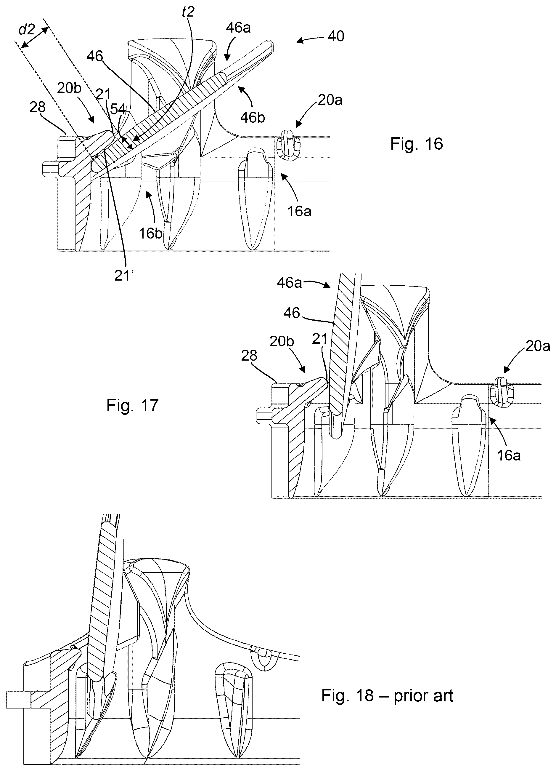 Patent US12310844 Figure 7 – Mechanical prosthetic heart valve