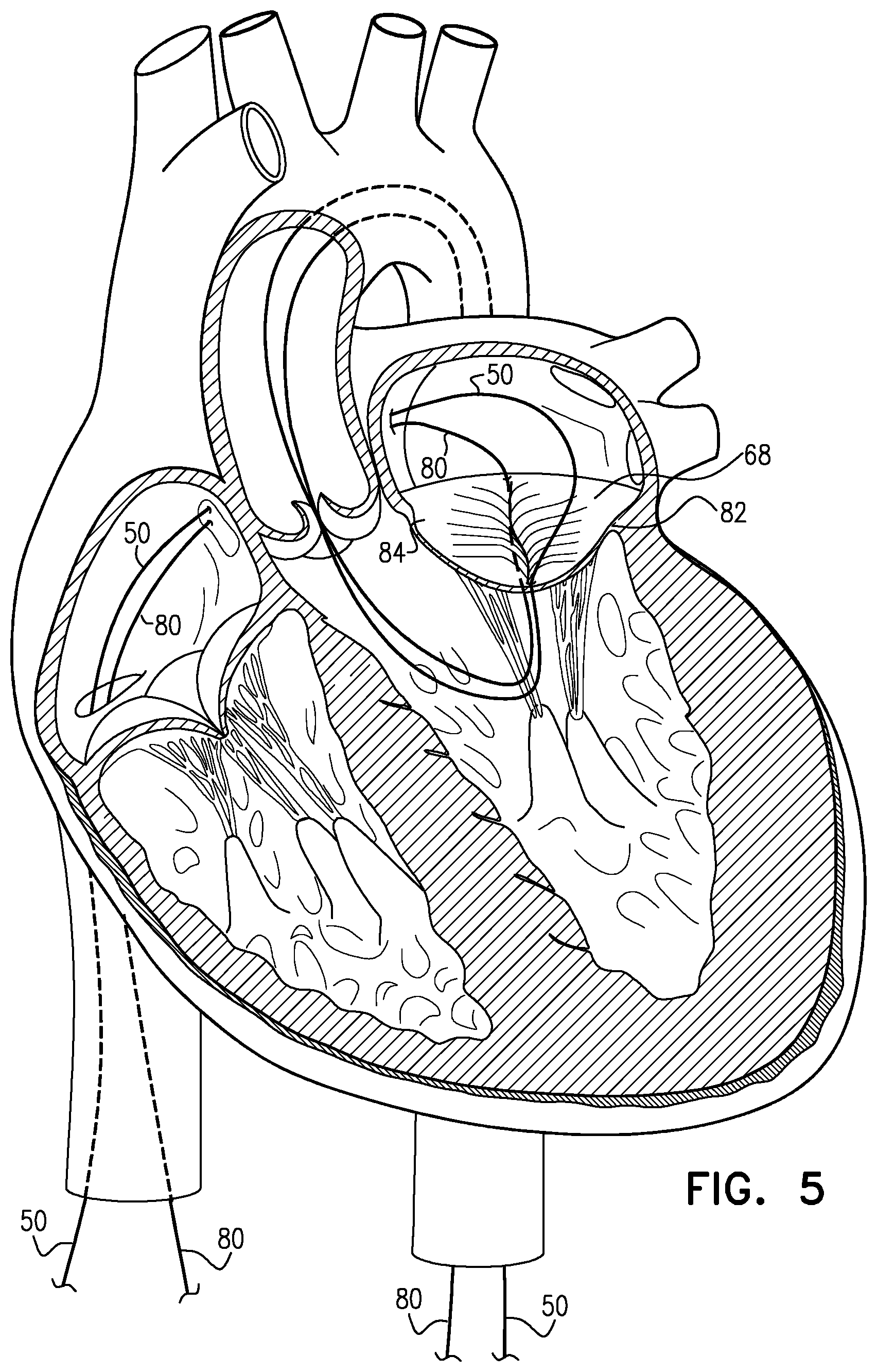 Patent US12310845 Figure 5 – Docking elements